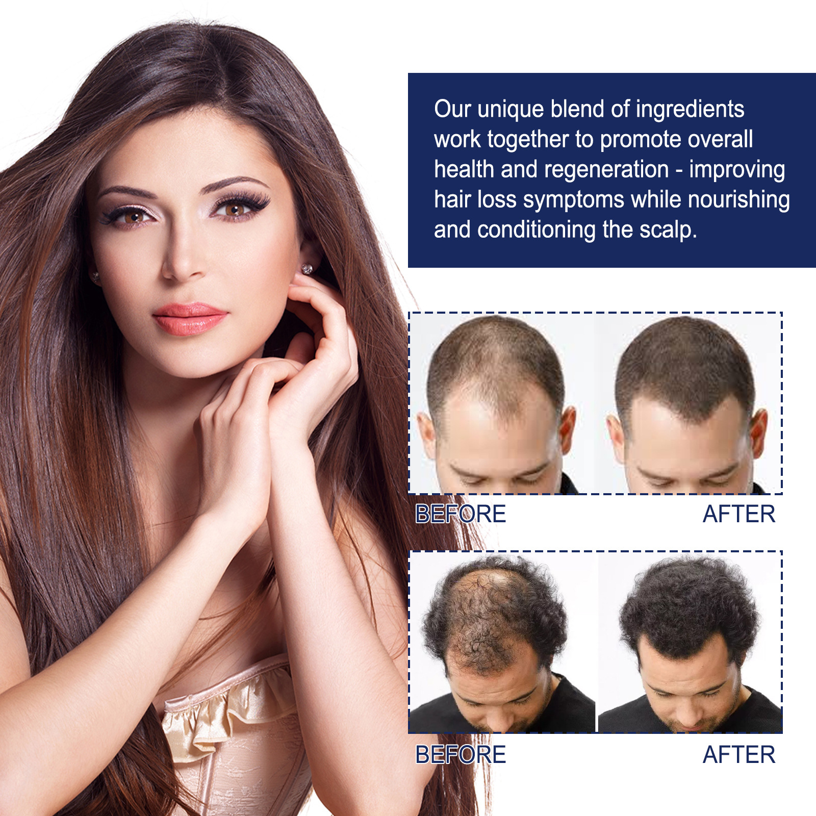 Herbal Hair Care Essential Oil Root Care Essential Serum Hair Strengthen Anti Hair Loss Dense Hair