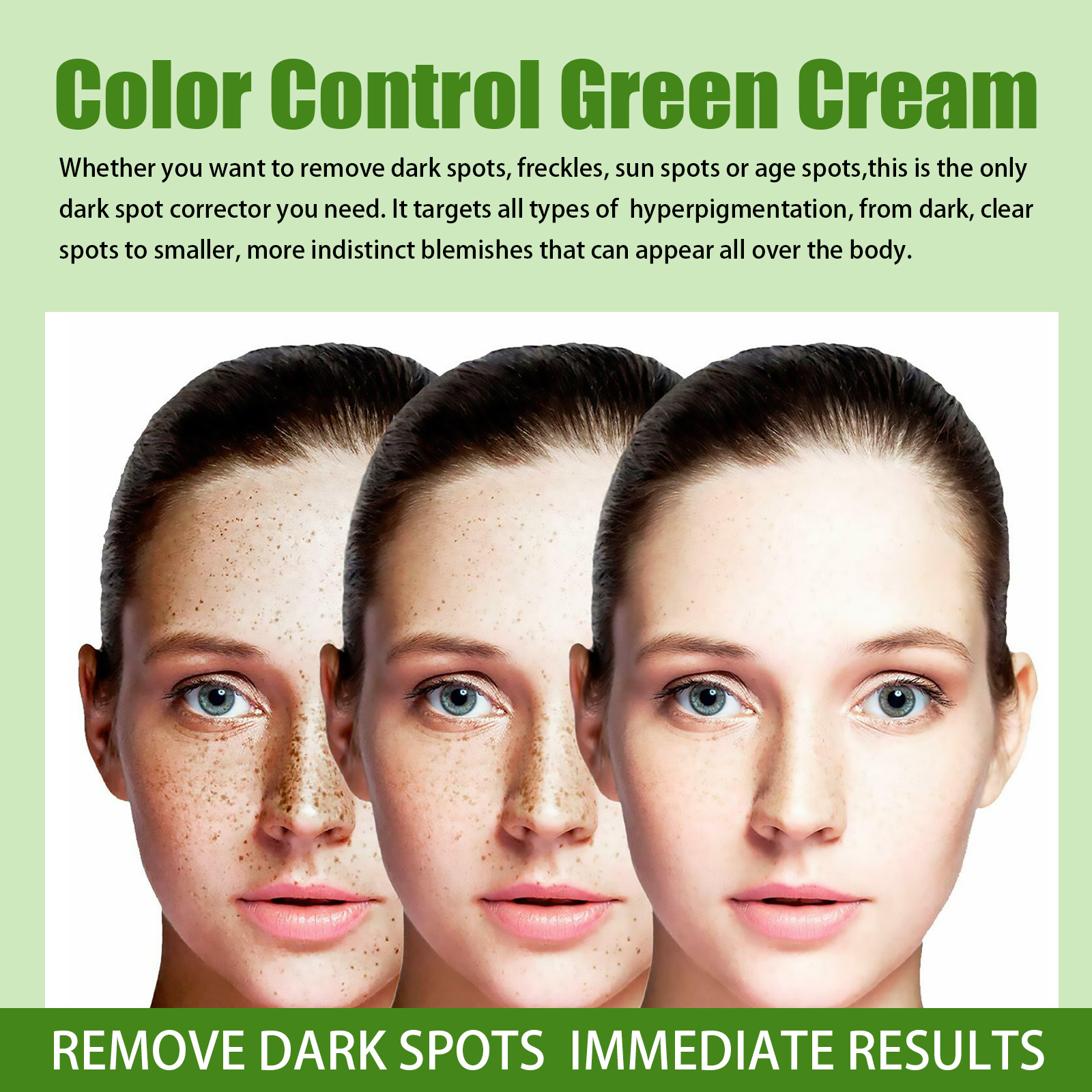 Whitening Freckles Cream Face Remove Melasma Dark Spots Lighten Melanin Melasma Remover Moisturizing Brighten Skin Care 30ml