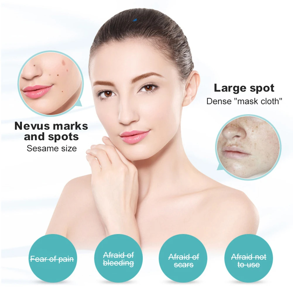 (White) Laser Plasma Pen Skin Tag Removal Mole Removal Freckles Warts Tattoo Dark Spot Removal LCD Multifunctional Beauty Tool Portable 9 Gears