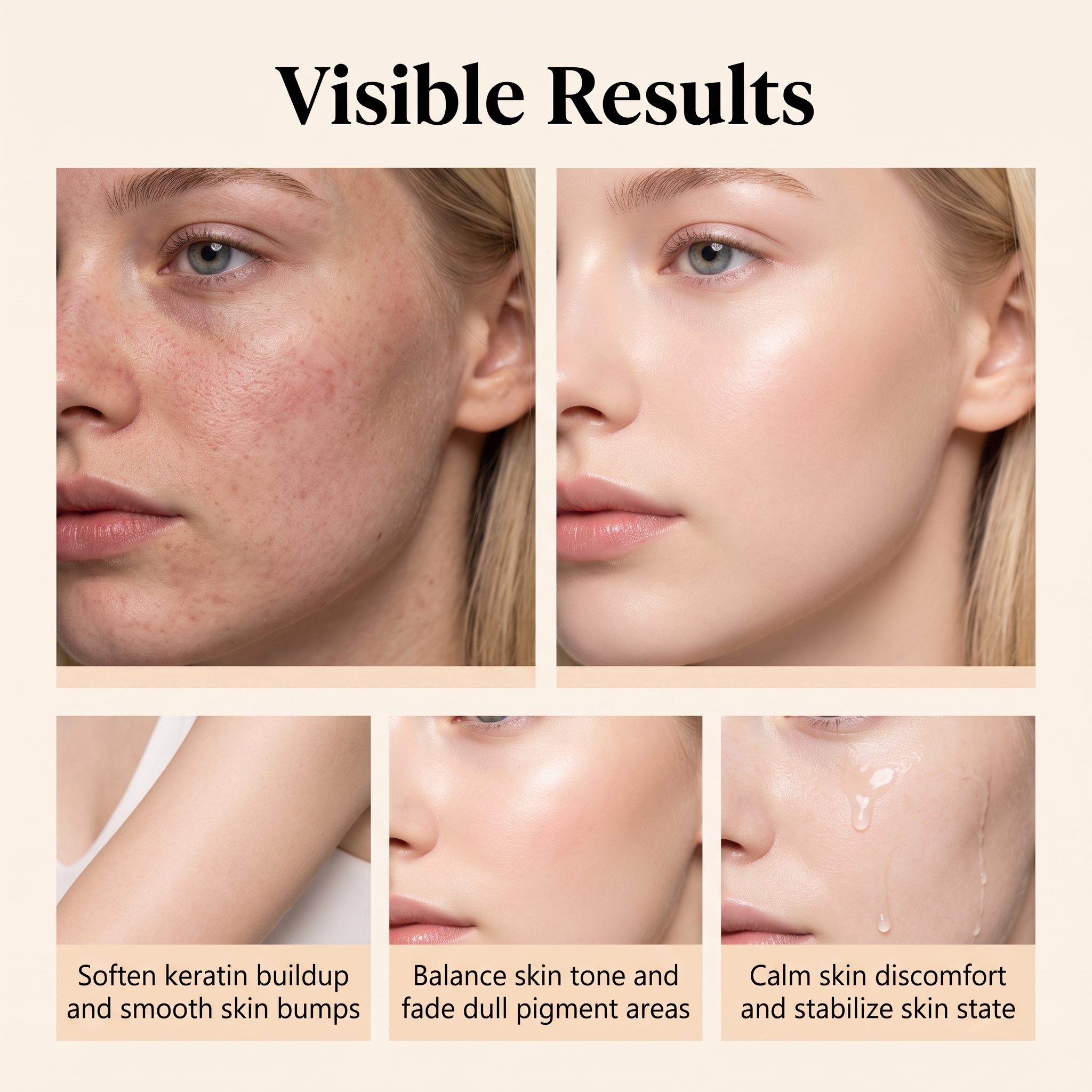 Dual Effect Skin Renewal Essence Moisturizing Mild Hydrating Soft Delicate Refreshing Daily Care Facial Skin Treatment