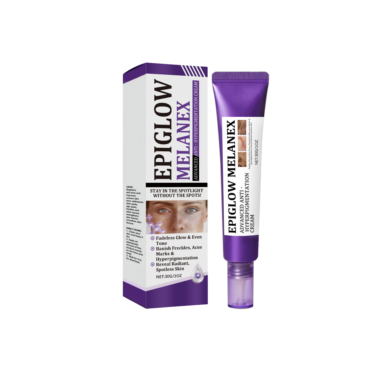 Retinol Freckle Cream Mild Care Facial Even Skin Tone Bright Hydrating Daily Nursing Face Lotion