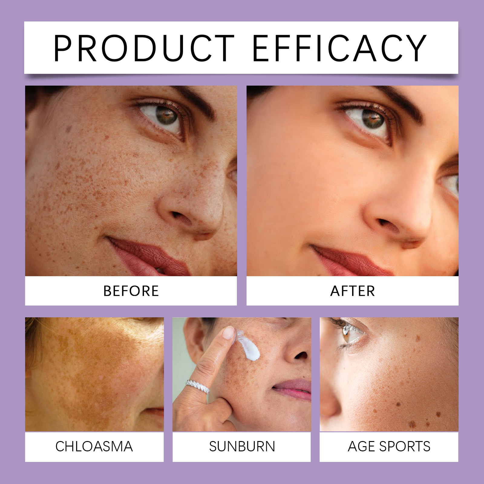 Retinol Freckle Cream Mild Care Facial Even Skin Tone Bright Hydrating Daily Nursing Face Lotion