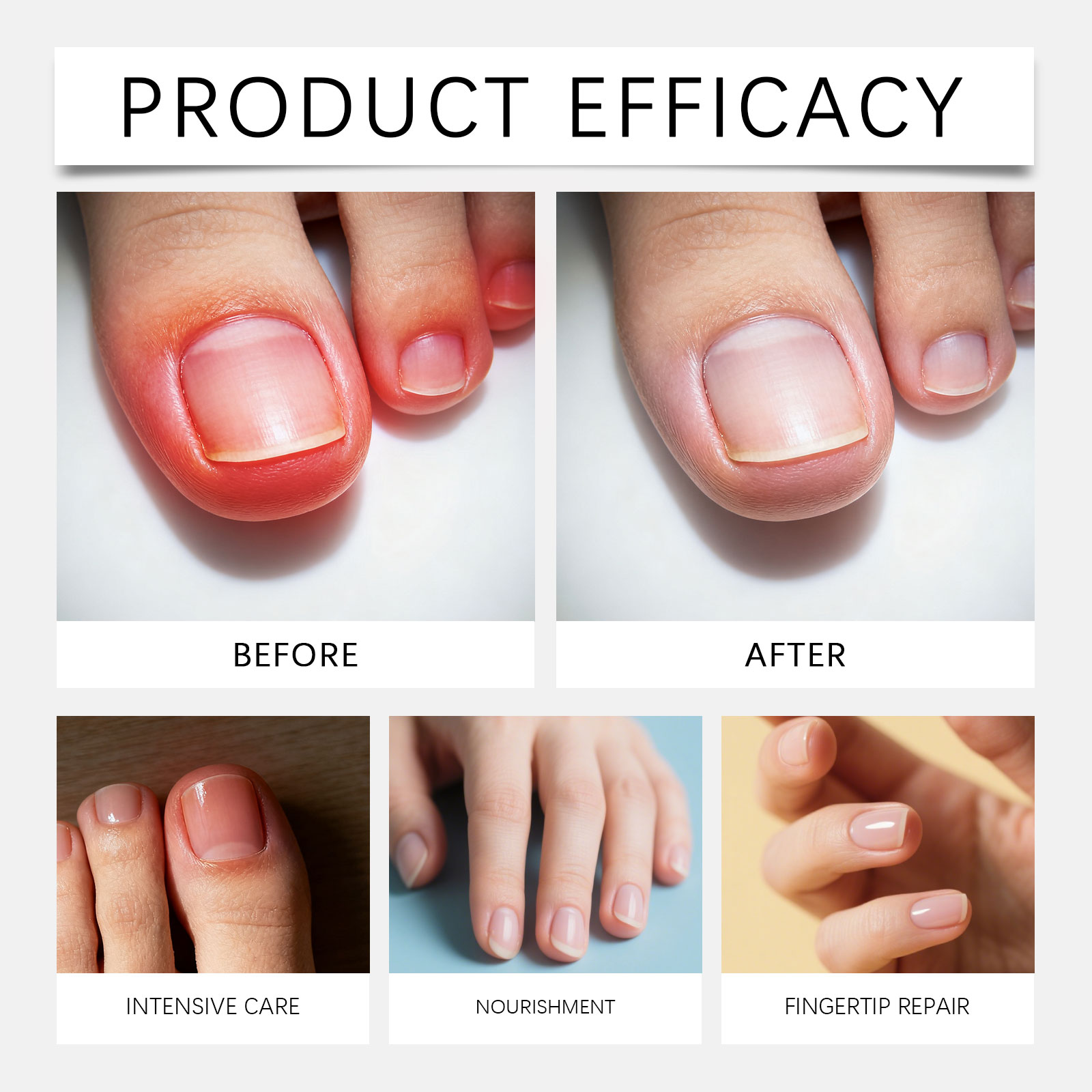 Nail Care Patch Gentle Protect Foot Nail Fit Nail Surface Thin Breathable Comfortable Daily Nail Care Sticker