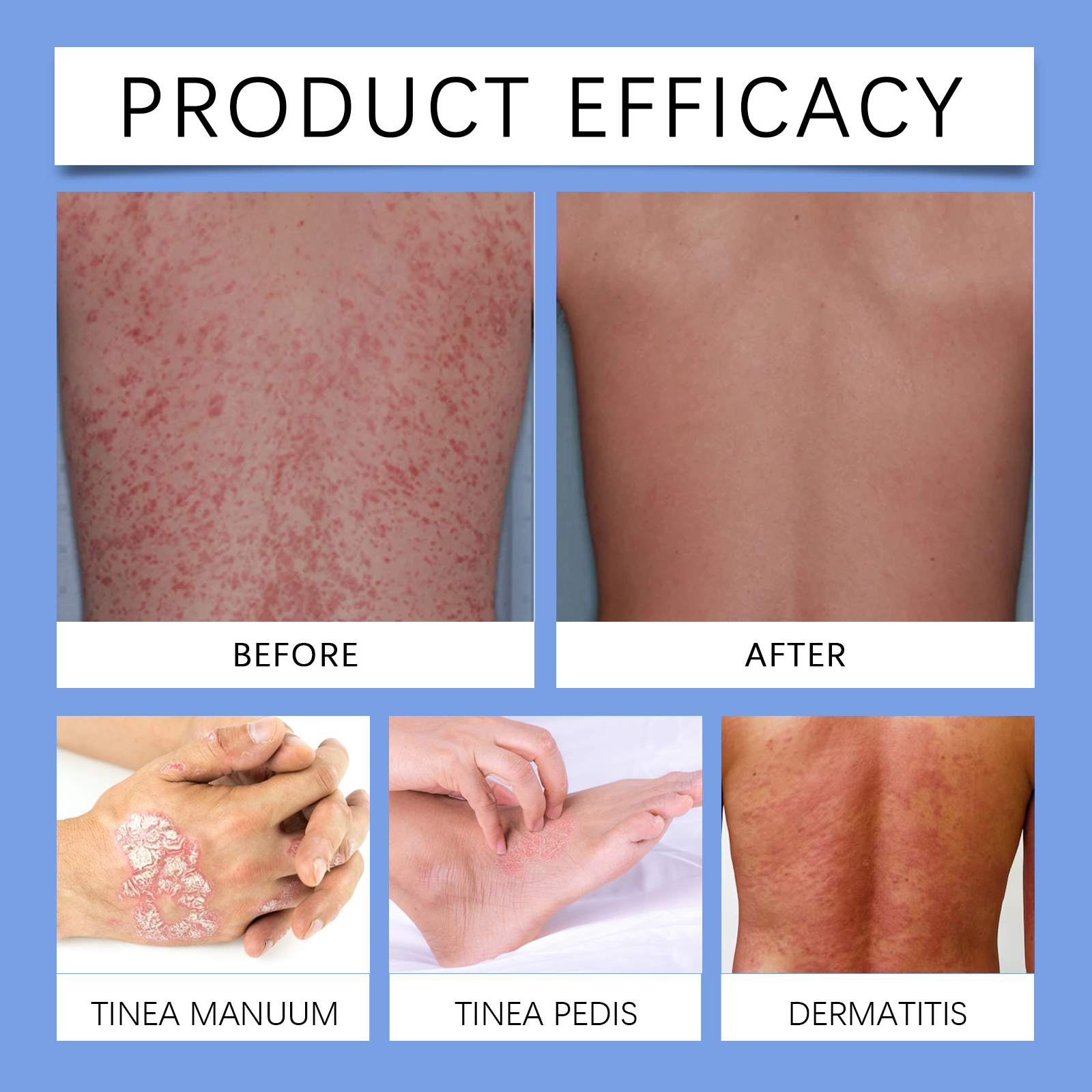 Skin Care Spray Refines Skin Whole Body Usable External Mild Skin Care Mist