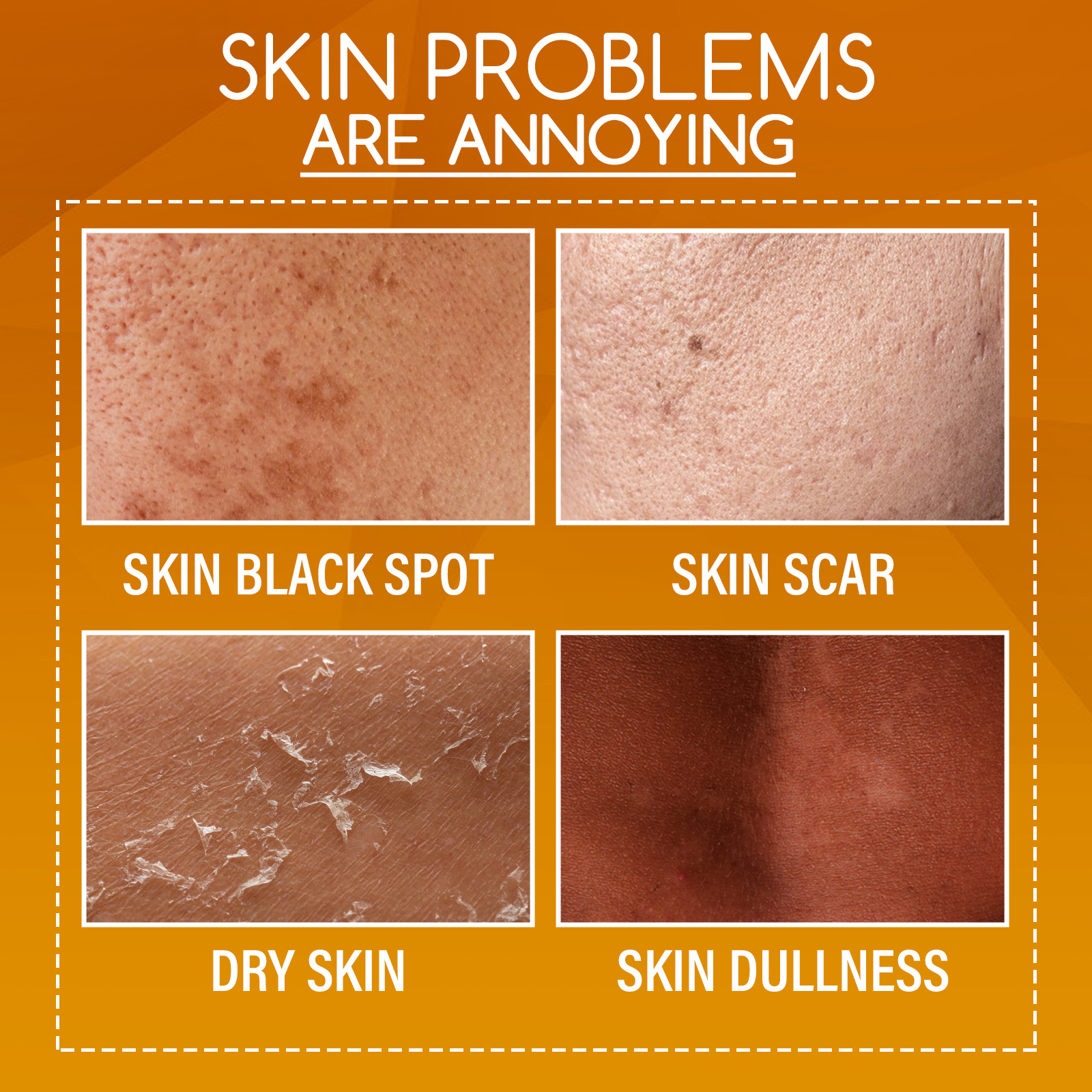 Orange Peel Body Lotion Vitamin C Hyaluronic Acid Centella For Exfoliating Dark Spot Fading And Skin Brightening Daily Care