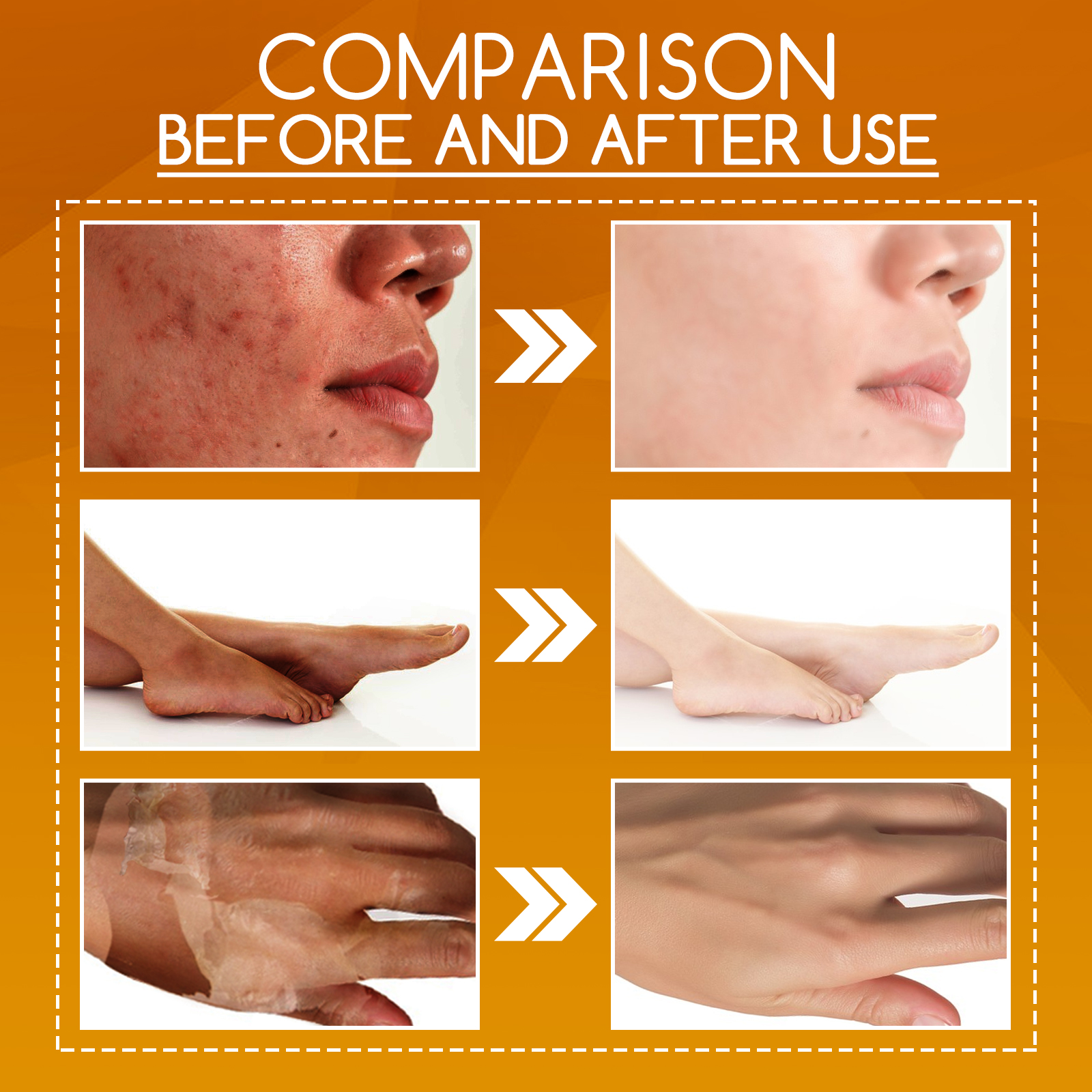 Orange Peel Body Lotion Vitamin C Hyaluronic Acid Centella For Exfoliating Dark Spot Fading And Skin Brightening Daily Care