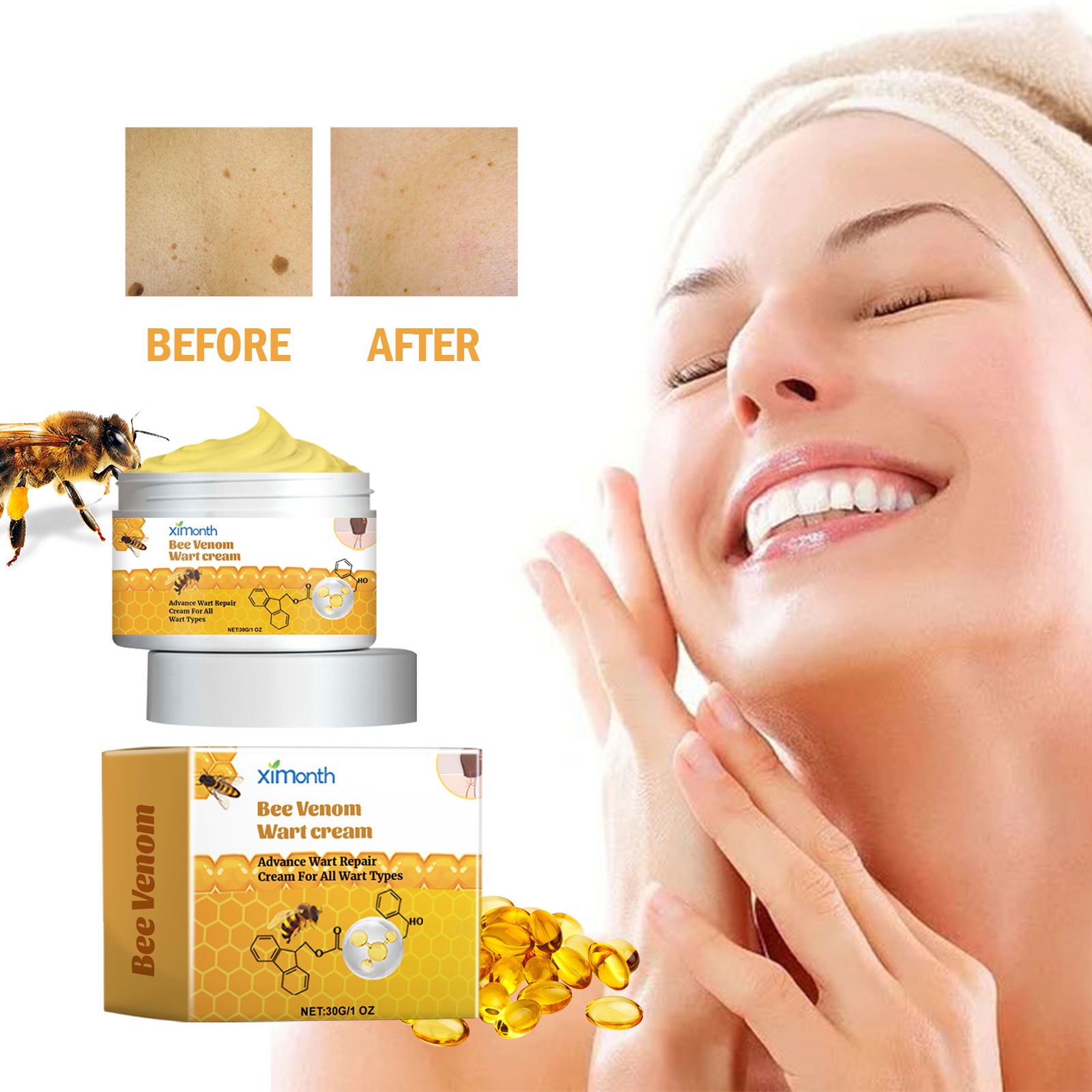 Bee Venom Skin Care Cream Gentle Cleansing For Skin Tags And Warts External Use