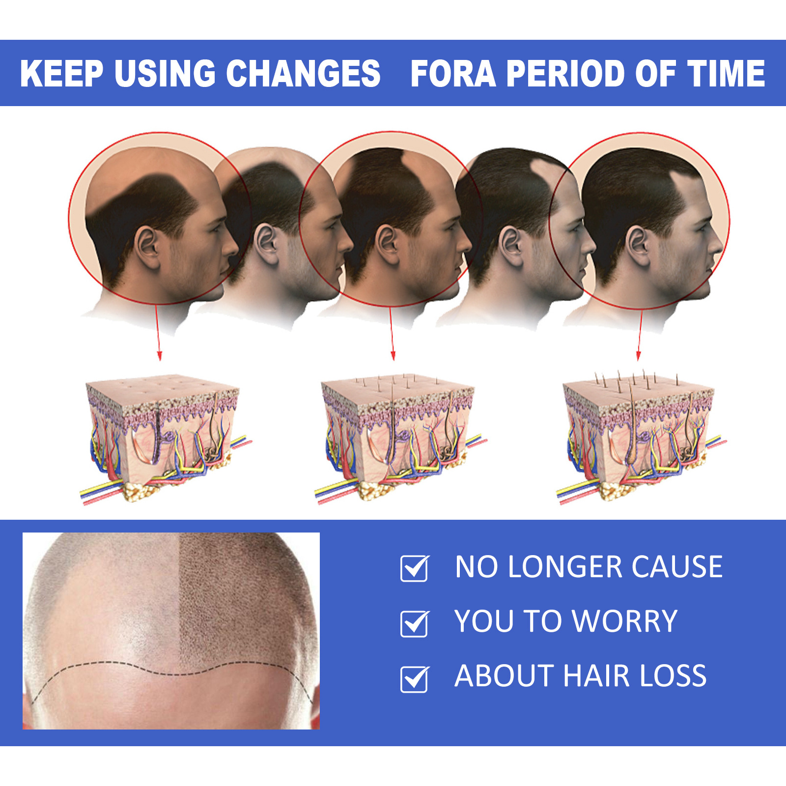 Ginger Hair Growth Spray Scalp Massage Hair Care Nutrient Solution 30ml
