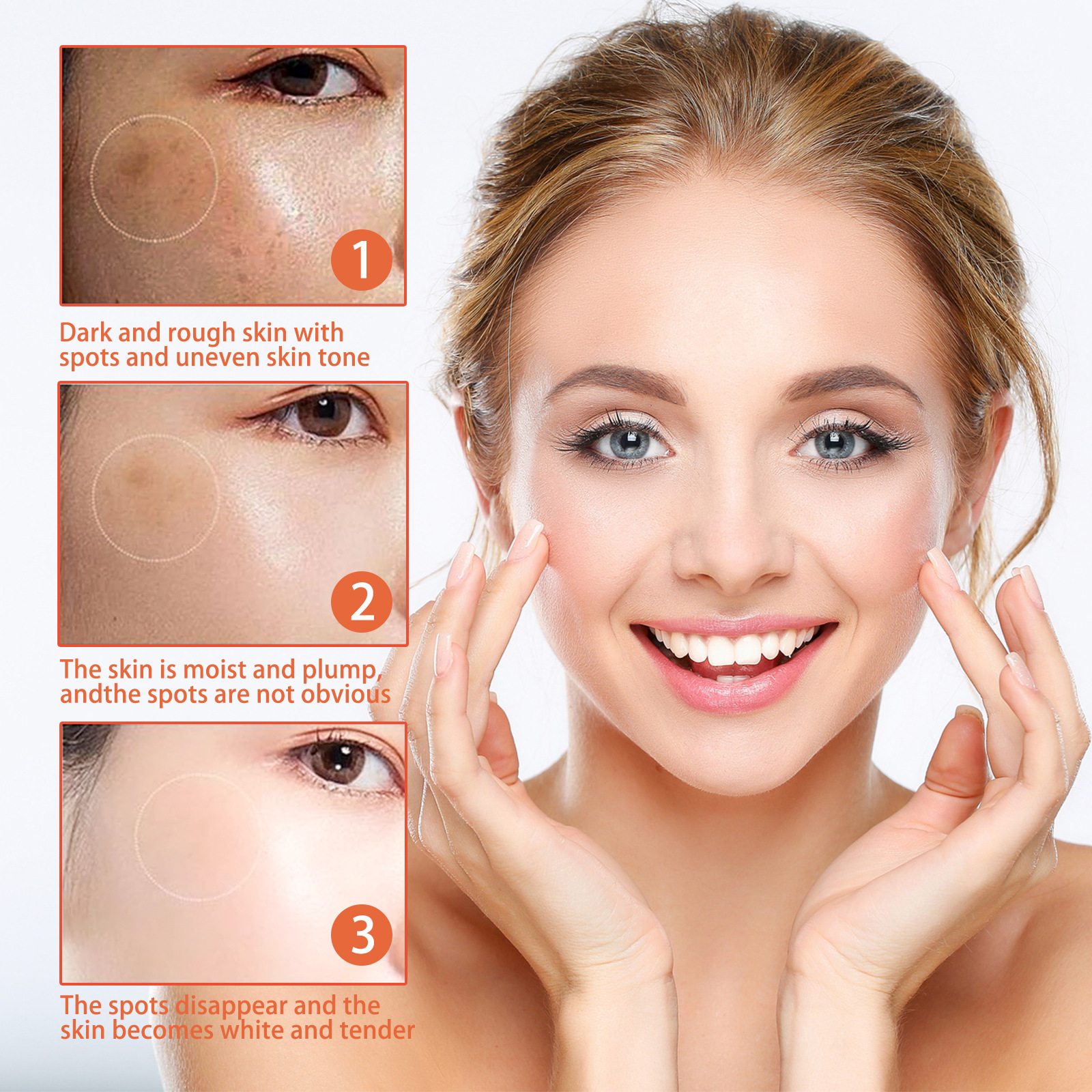 Brightening Facial Cream Whitening Moisturizing Nourishing Skin Cream Acne Dark Spot Remover Anti Age Spots Melasma Freckle Dull Complexion Removal