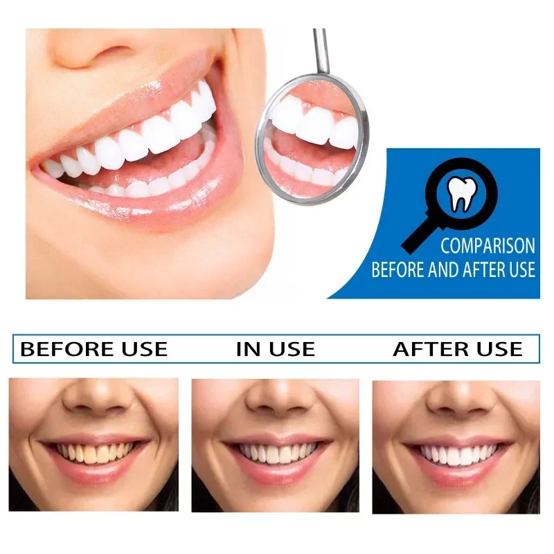 Cleaning Tooth Whitening Essence Teeth Whiteners Effective Remove Plaque Serum Yellow Teeth Tooth Stains Removal Serum Fresh Breath Toothpaste 10ml