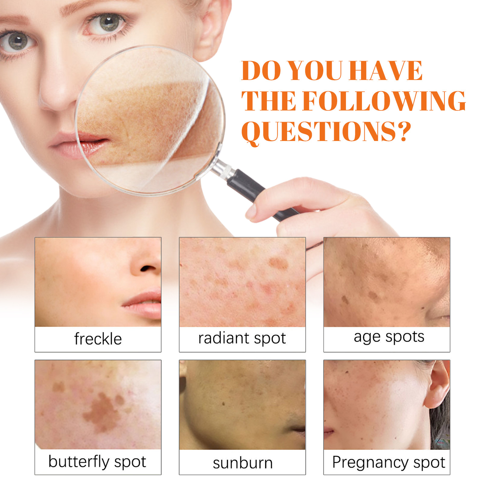 Whitening Freckle Cream Melanin Blemish Remover Lighten Pigmentation Melasma Removal Whiten Nourish Dark Spot Corrector Cream Day Night Cream