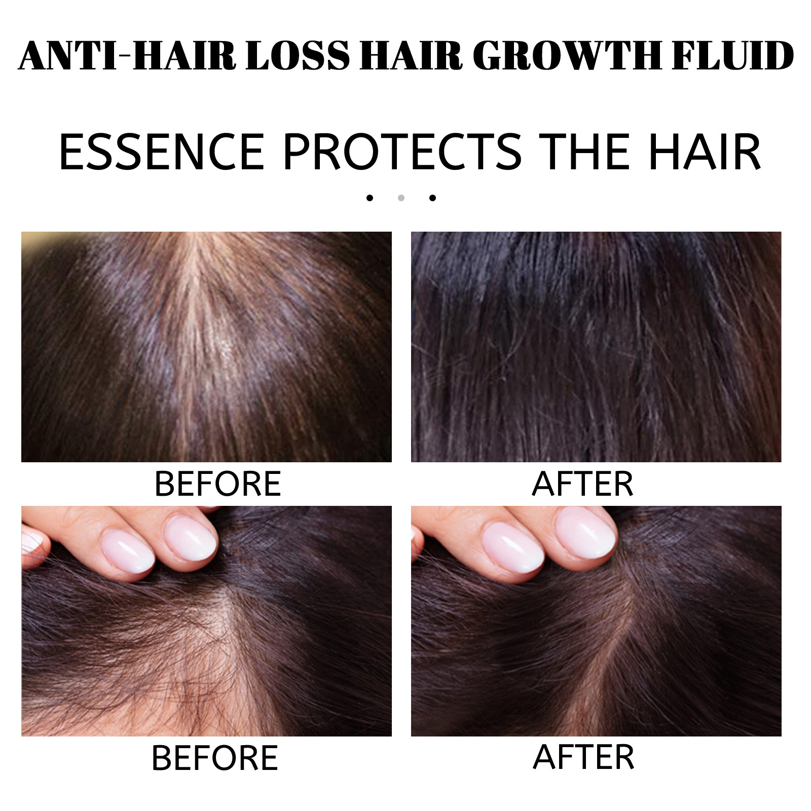 Hair Growth Essential Oil Essence Original Authentic Prevent Hair Loss Liquid Care Beauty Hair Growth Spray Hair Care Serum 30ml