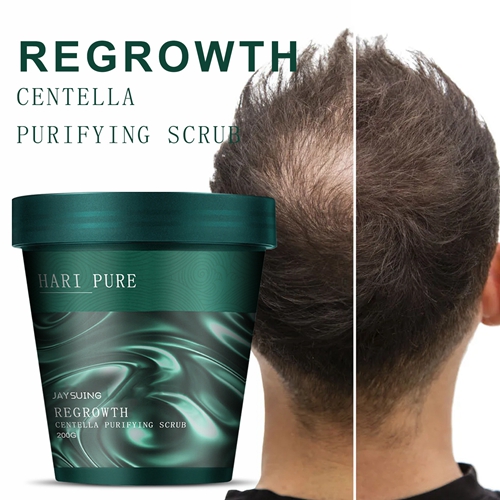 Centella Exfoliating Scrub for Hair Oil Control Deep Cleansing Dandruff Removal Repair Damaged Hair Scalp Massage Scrub Cream