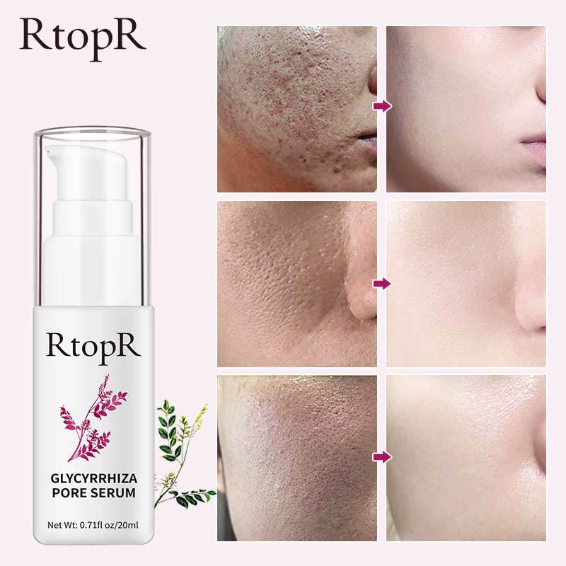 Glabridin Pore Tightening Essence For Minimizing Pores Hydrating And Skin Smoothing Daily Care Treatment 20ml