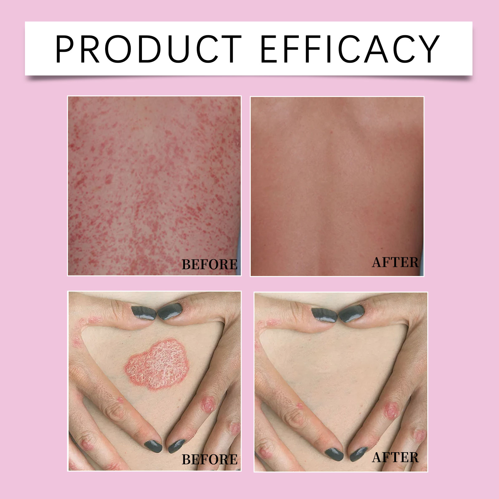 Skin Care Essence Cream Mild Protect Comfort Skin Hydrate Moisturize Daily Apply Body Massage Lotion