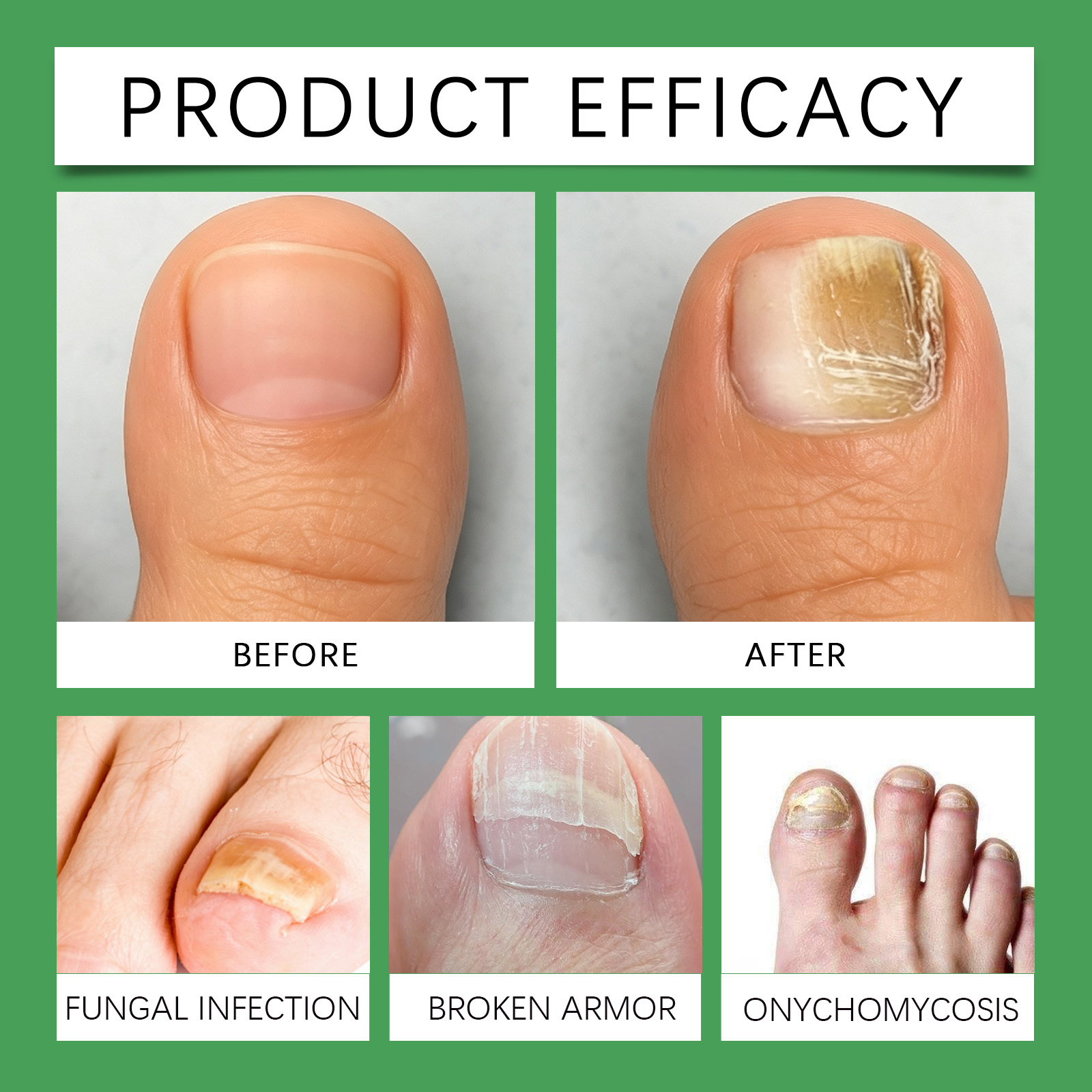 Nail Care Essence Oil Mild Moisturizing Bright Repair Soften Cuticle Nail Surround Skin