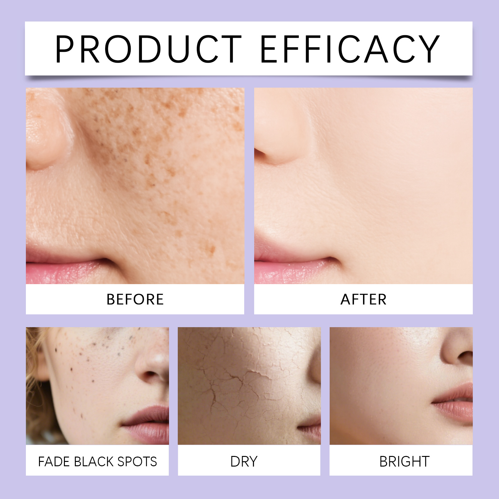 Retinol Moisturizer Cream Mild Ingredients Nourish Hydrate Soft Smooth Skin Bright Daily Facial Care