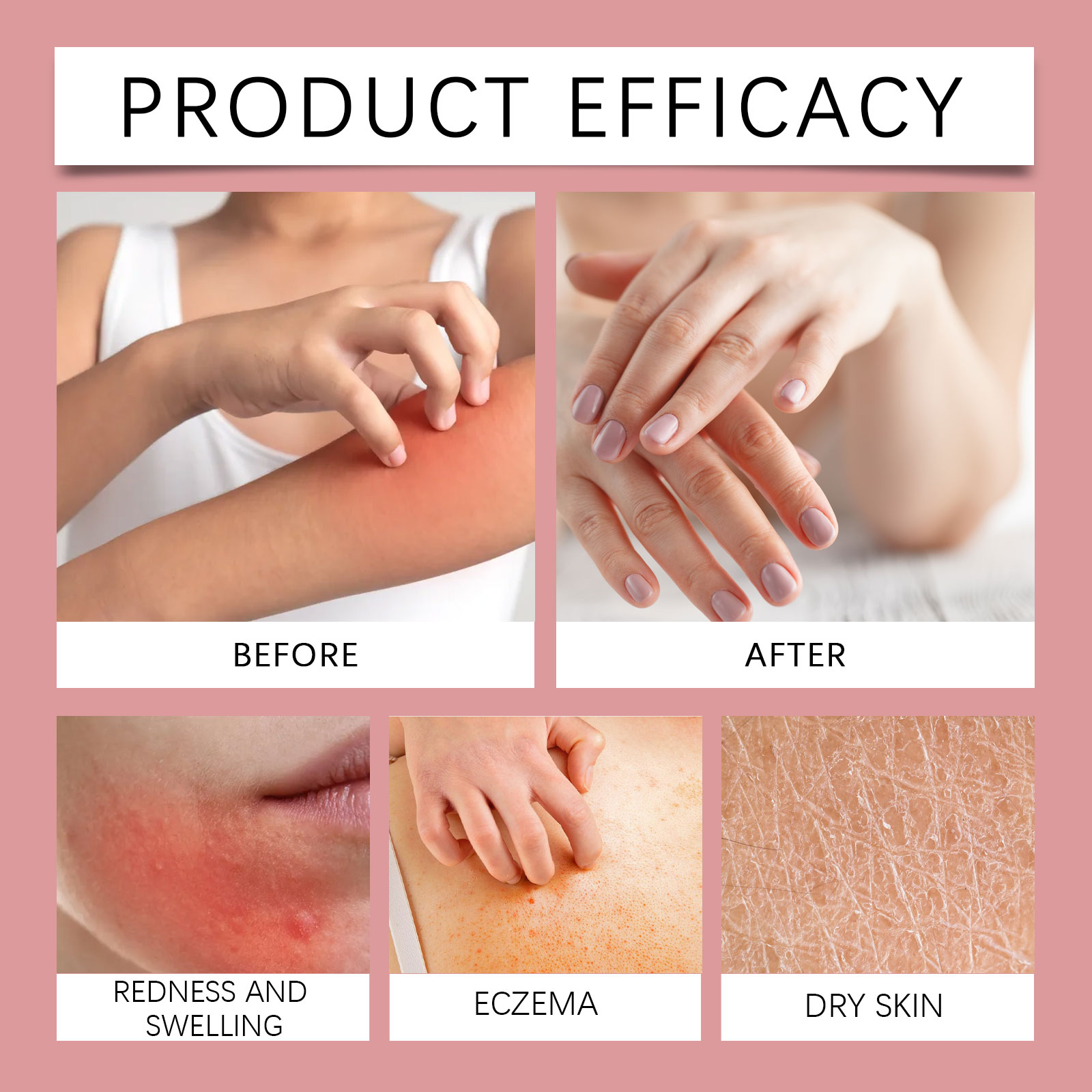 Body Care Patch Mild Formula Clean Skin Tight Fit Comfort Breathable Daily Convenient Sticker