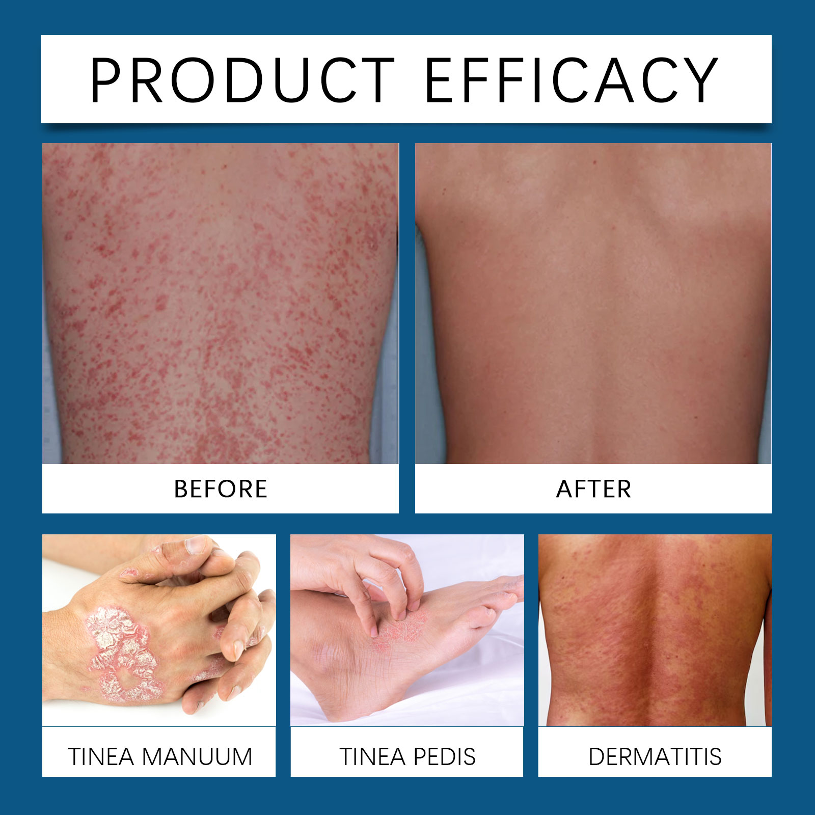 Magnesium Cream Moisturizing Nourishing Delicate Smooth Gentle Care For Body Skin