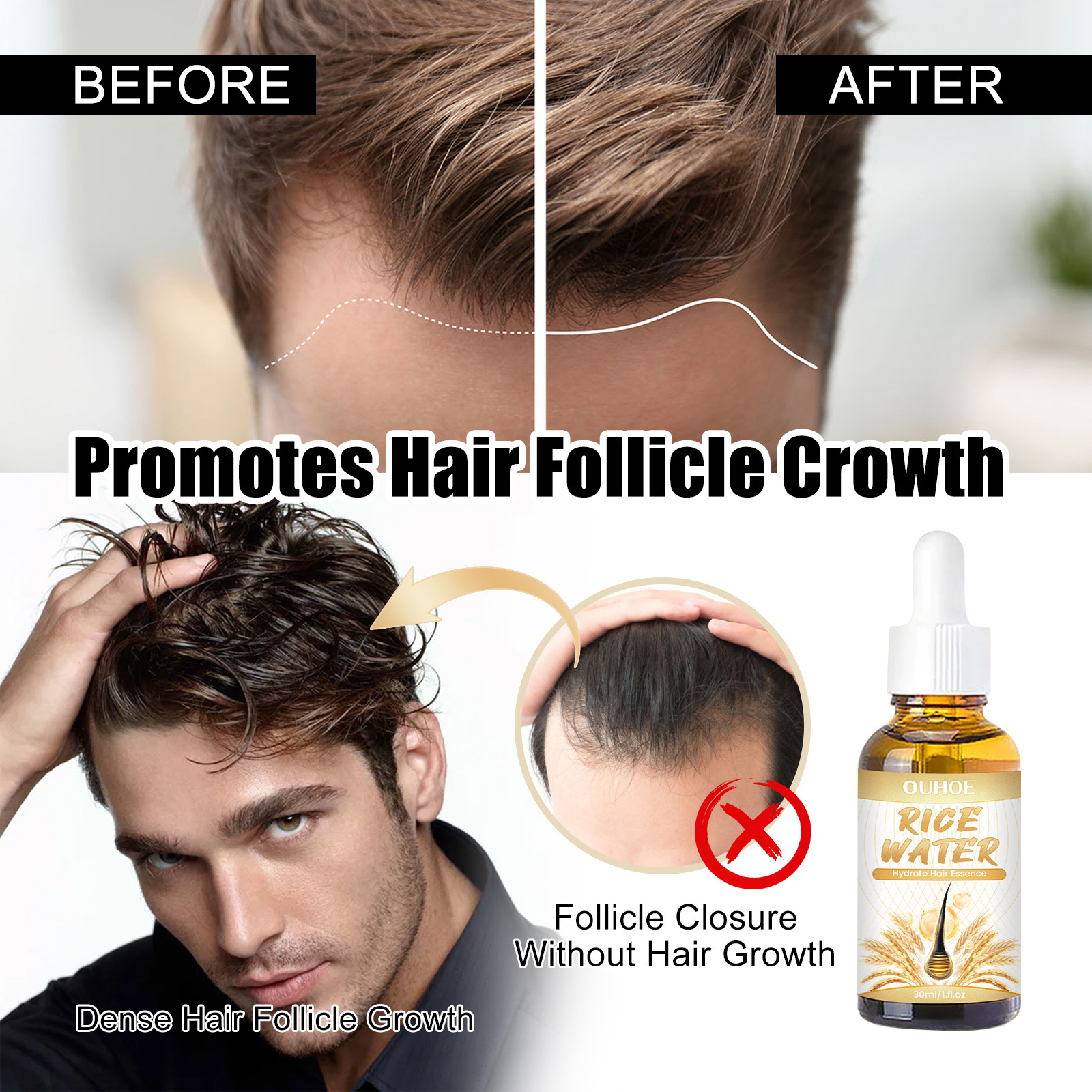 Rice Water HGrow Hair Essence Hair Serums Hair Care Longer Stronger Healthier Fuller Thicker Hair For Women 30ml