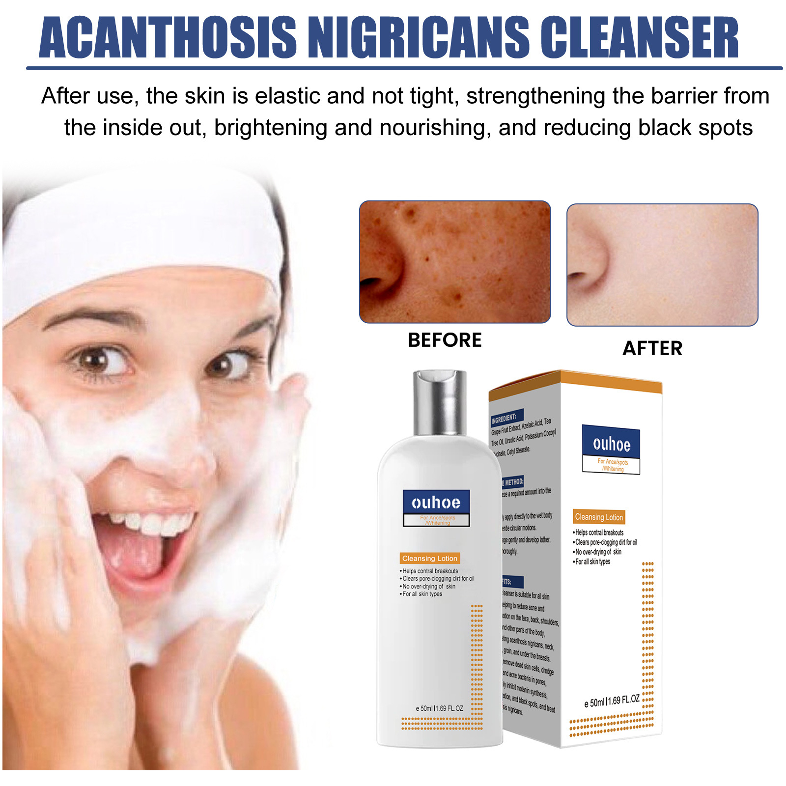 Cleansing Lotion Whitening Face Cleanser Oil Control Cleanser Acne Spots Deep Cleaning Reducing Pores Moisturizing Facial Repair Brightening Skin Tone