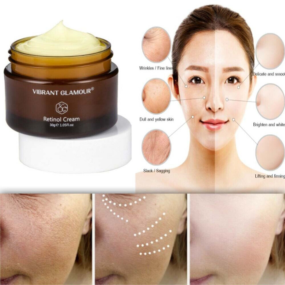 Whitening Cream Retinol Removes Melasma Acne Spots Pigment Dark Spots Pigment