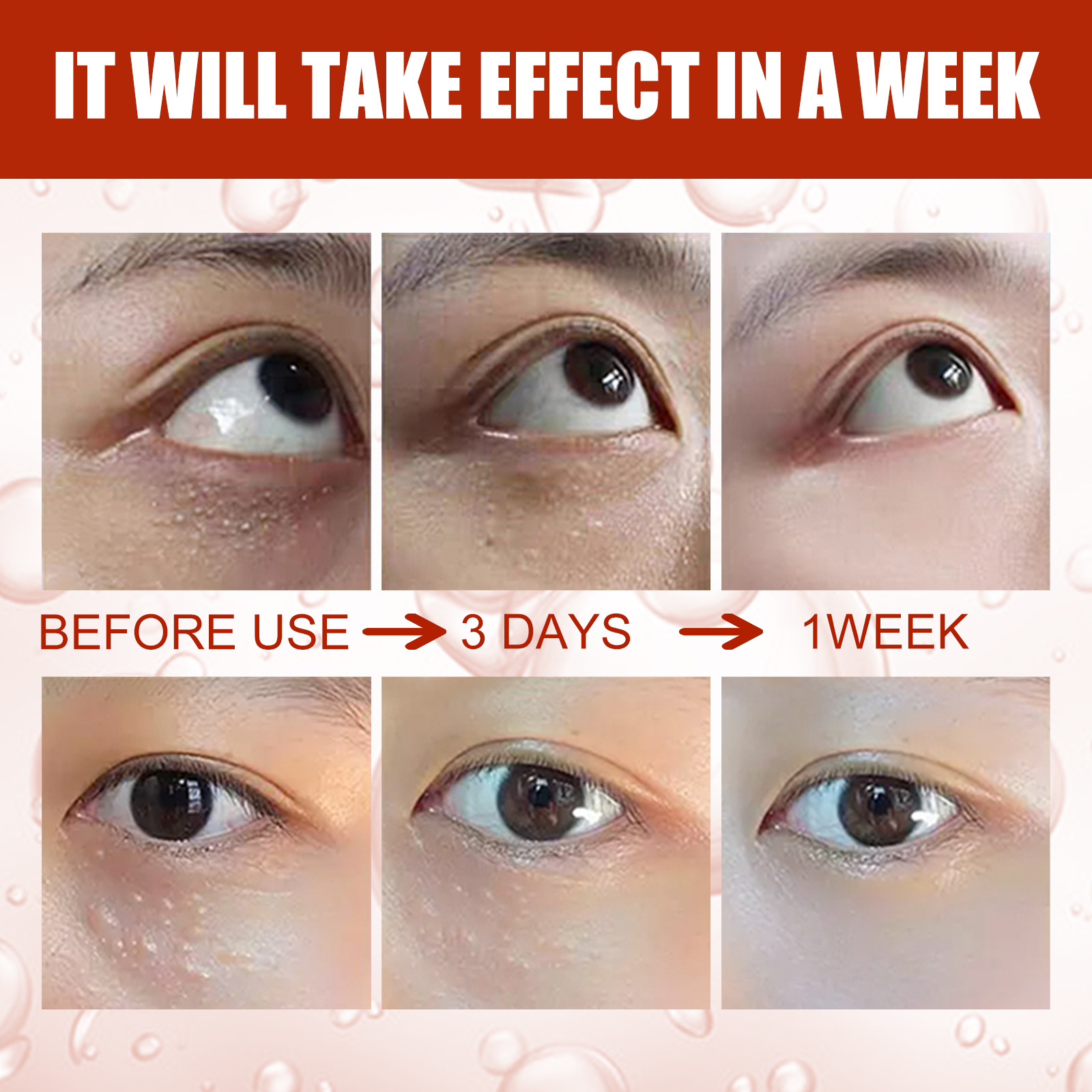 Anti-fat Granule Essence Remove Particles Around the Eyes Fade Fine Lines Firming and Lifting Eye Serum Beauty Care