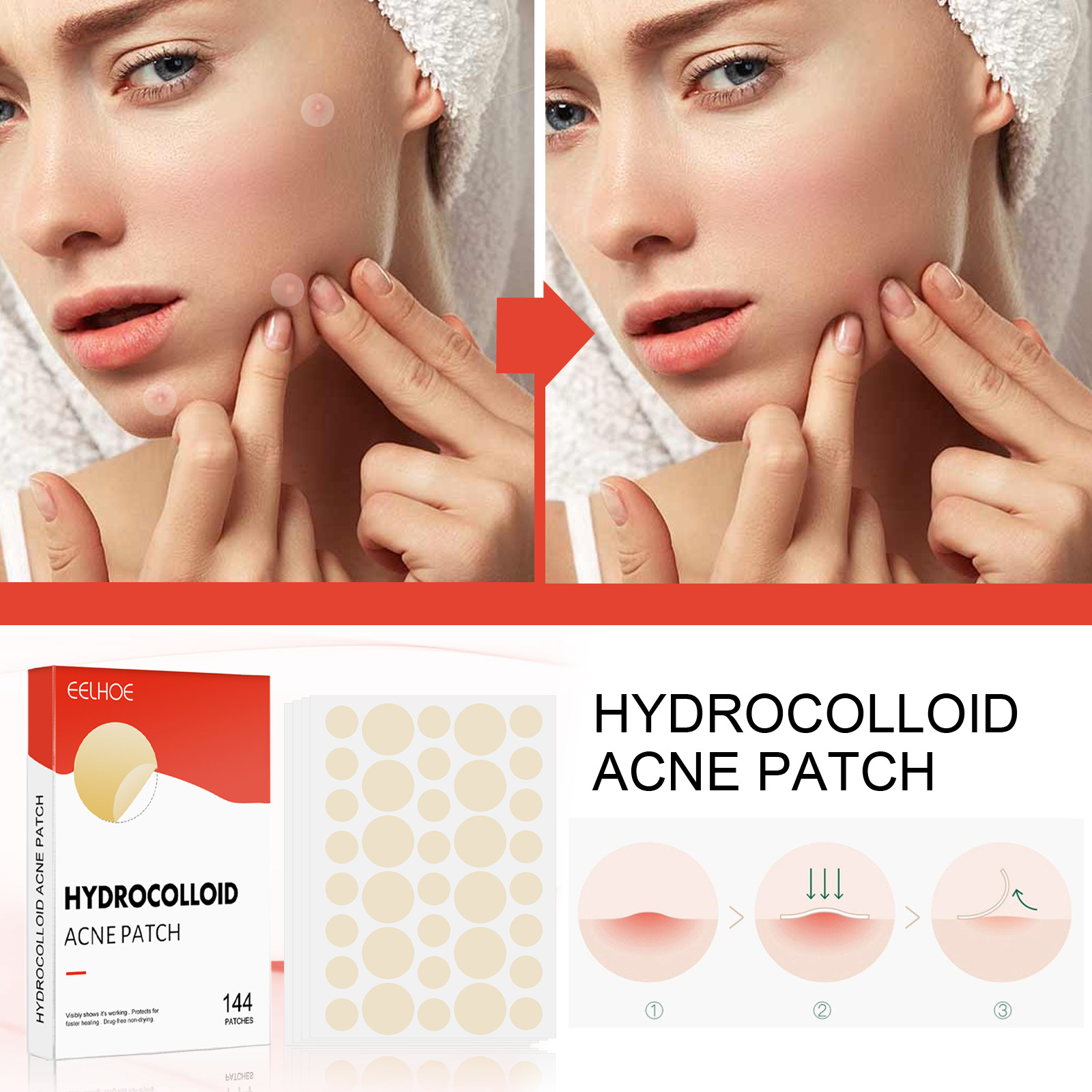 Hydrocolloid Acne Pimple Patch 144pcs Set Invisible Healing Absorbing Spot Sticker Covering Men Women Face Spot Scar Care Acnes Face Skin Care