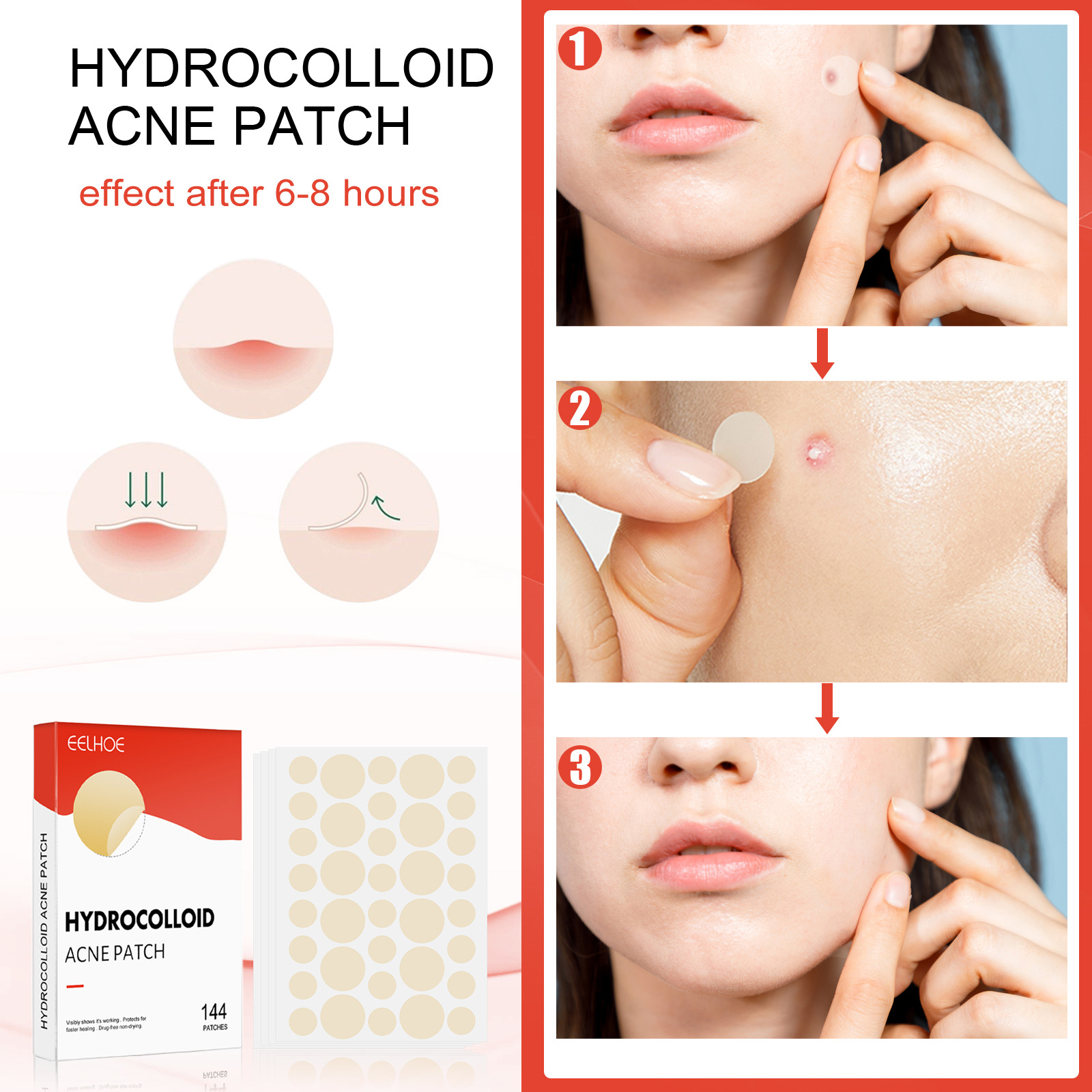 Hydrocolloid Acne Pimple Patch 144pcs Set Invisible Healing Absorbing Spot Sticker Covering Men Women Face Spot Scar Care Acnes Face Skin Care