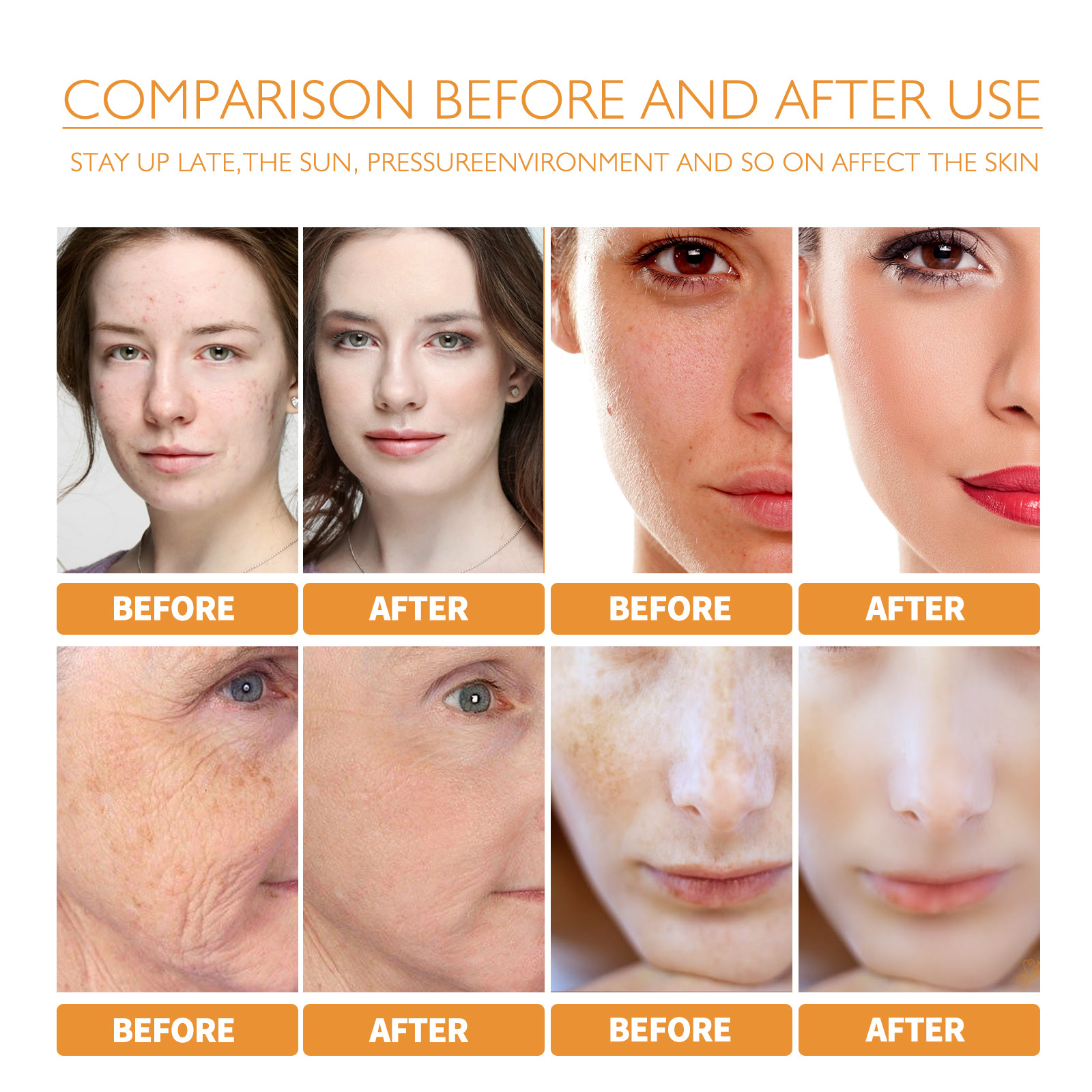 (1 PC) Turmeric Face Essence Anti Oxidant Brightening Nourish Moisturizing Skin Essence Blemishes Lighten Acne Marks Fade Melanin Freckle Repair Essence Skin Care