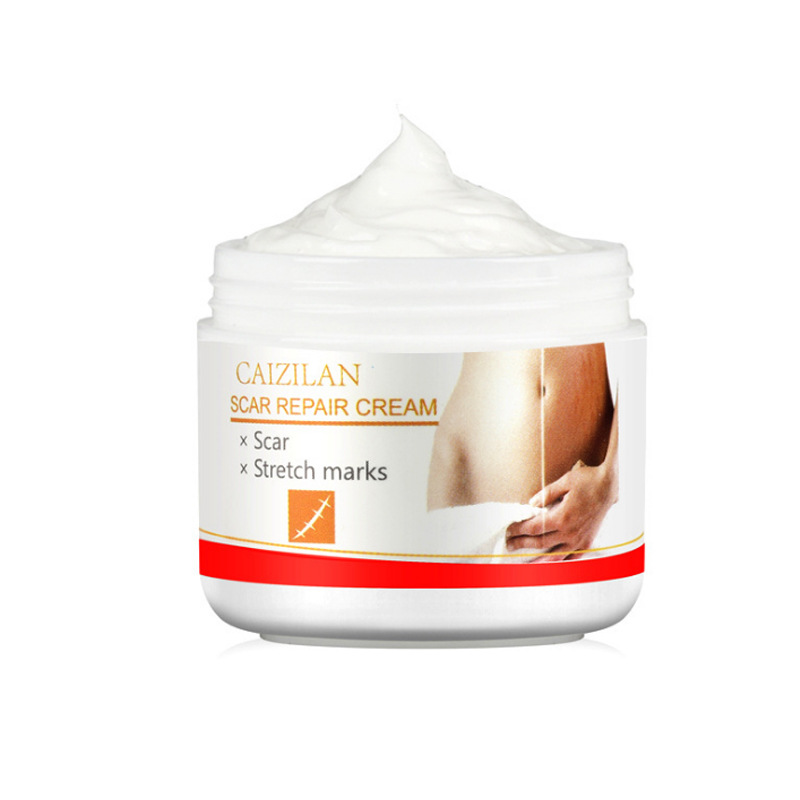 Pregnancy Cream Postnatal Nourishing Balm Skin Smoothing Cream for Body Care Home Use Natural 30g
