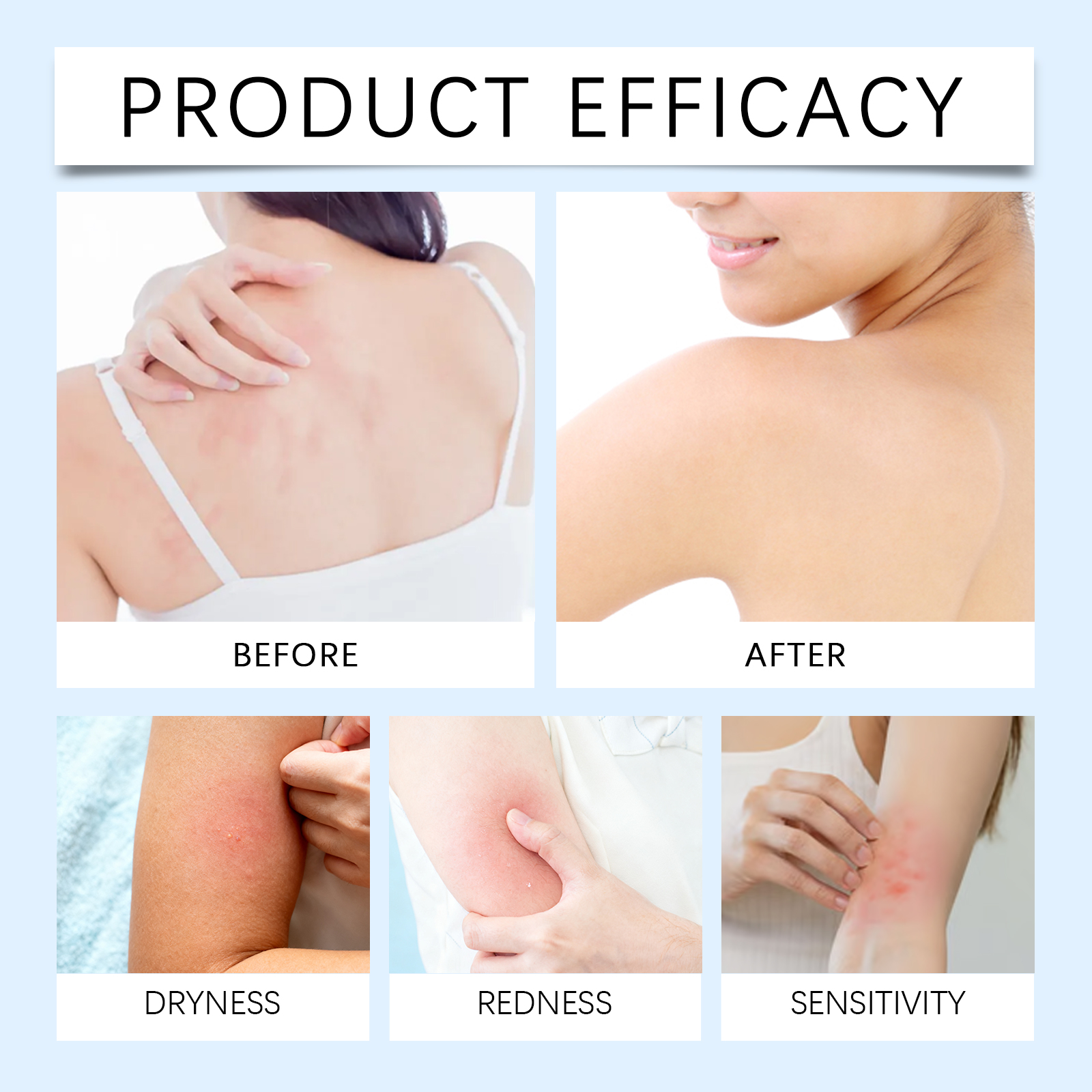 Skin Comfort Care Cream Daily Nourishing Soft Smooth Tender Body Skin External Smearing Treatment Lotion