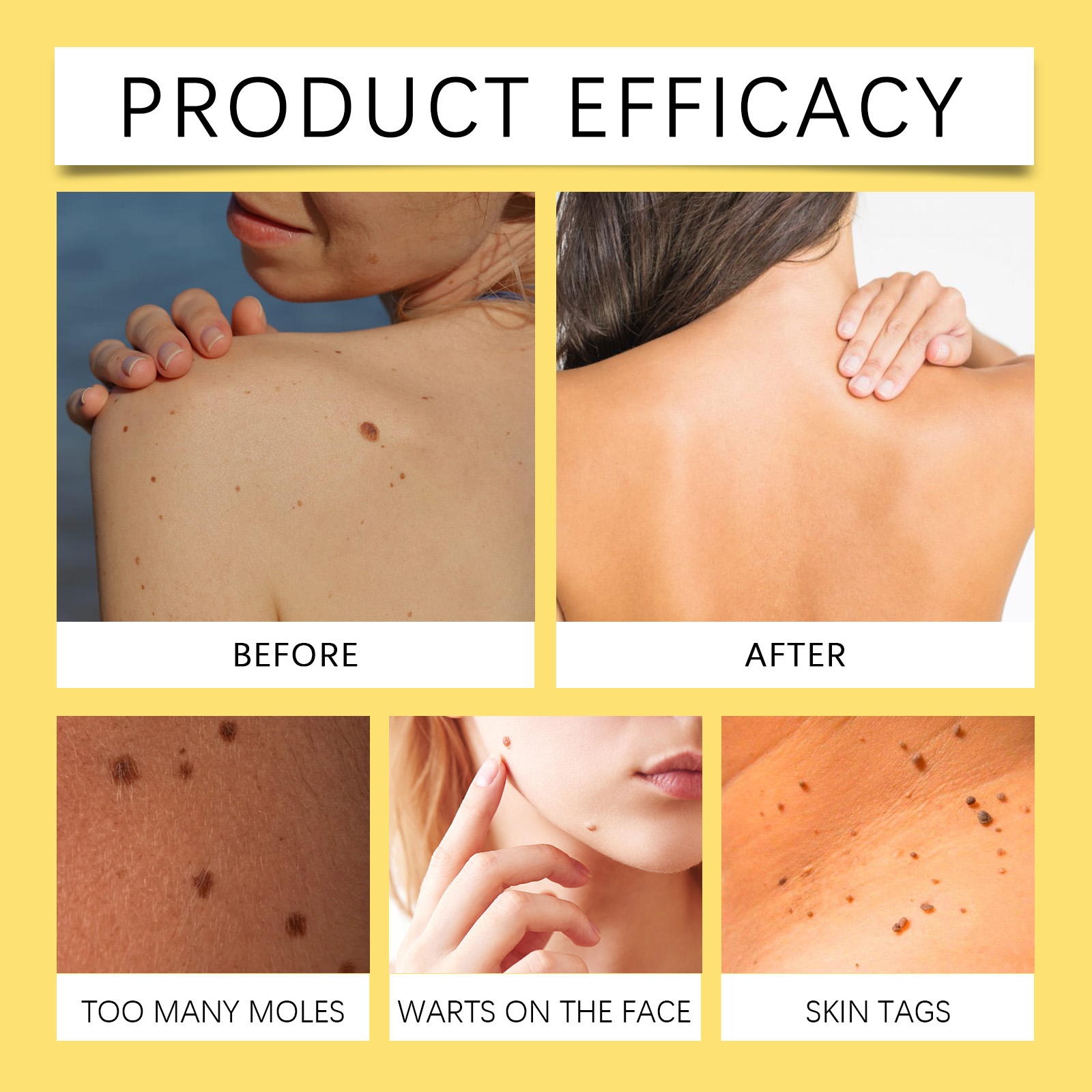 Bee Venom Skin Care Cream Gentle Nourish Skin Remove Mole Clean Smooth Rejuvenate Cream