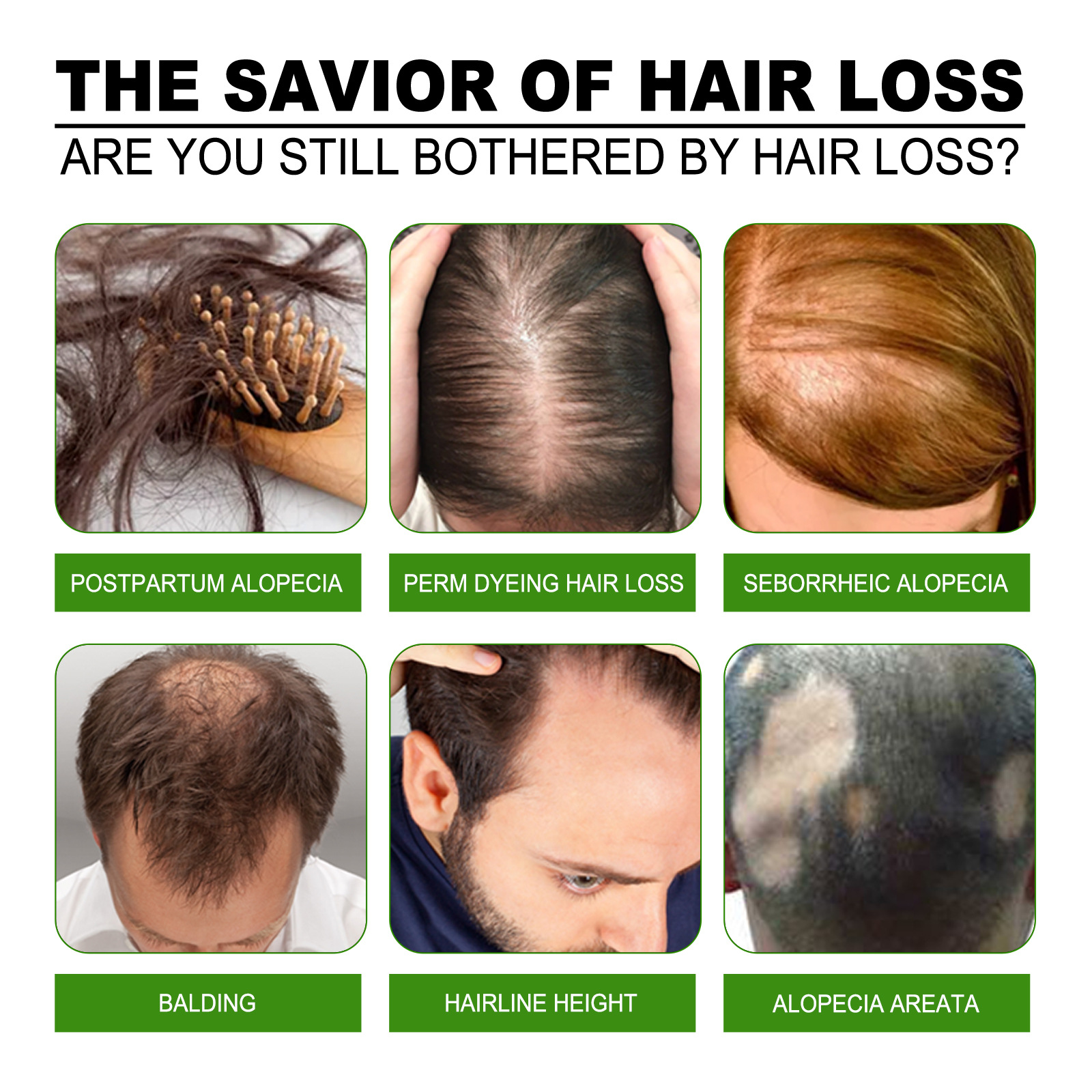 Hair Growth Serum Hair Essence Hair Nourishing Solution Liquid Treatment Anti Hair Loss Hair Care Dense