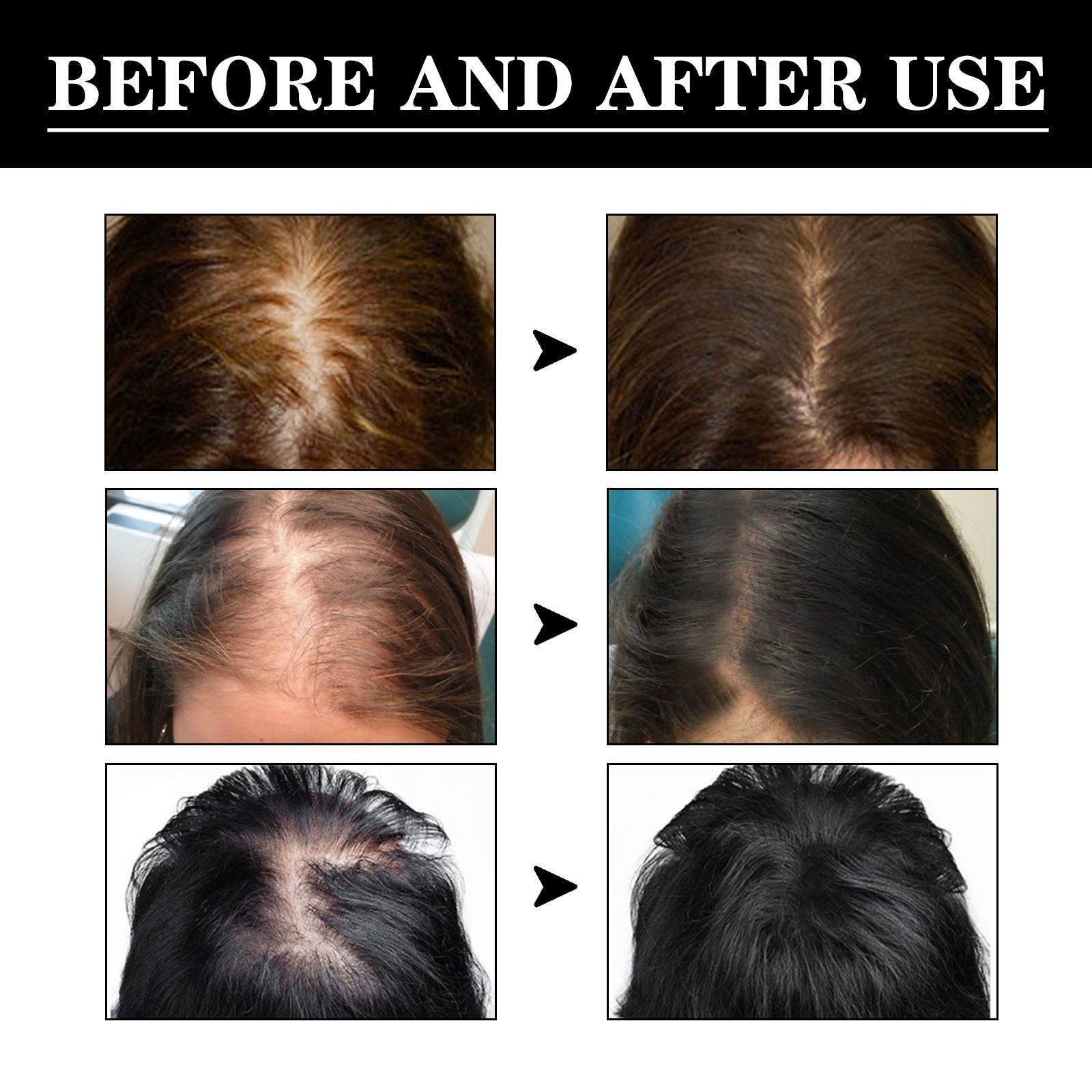 Hair Growth Serum Hair Care Essence Beard Essential Oils Moisturizing Hair Essence Natural Thickening Baldness Unisex