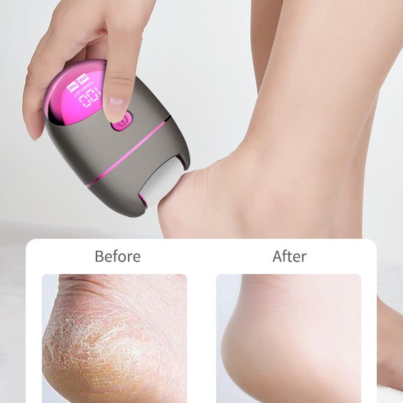 Electric Callus Remover for Feet Waterproof Rechargeable Foot Files Pedicure Tools for Dead Skin and Cracked Skin Foot Daily Care LCD Display Ideal Gift