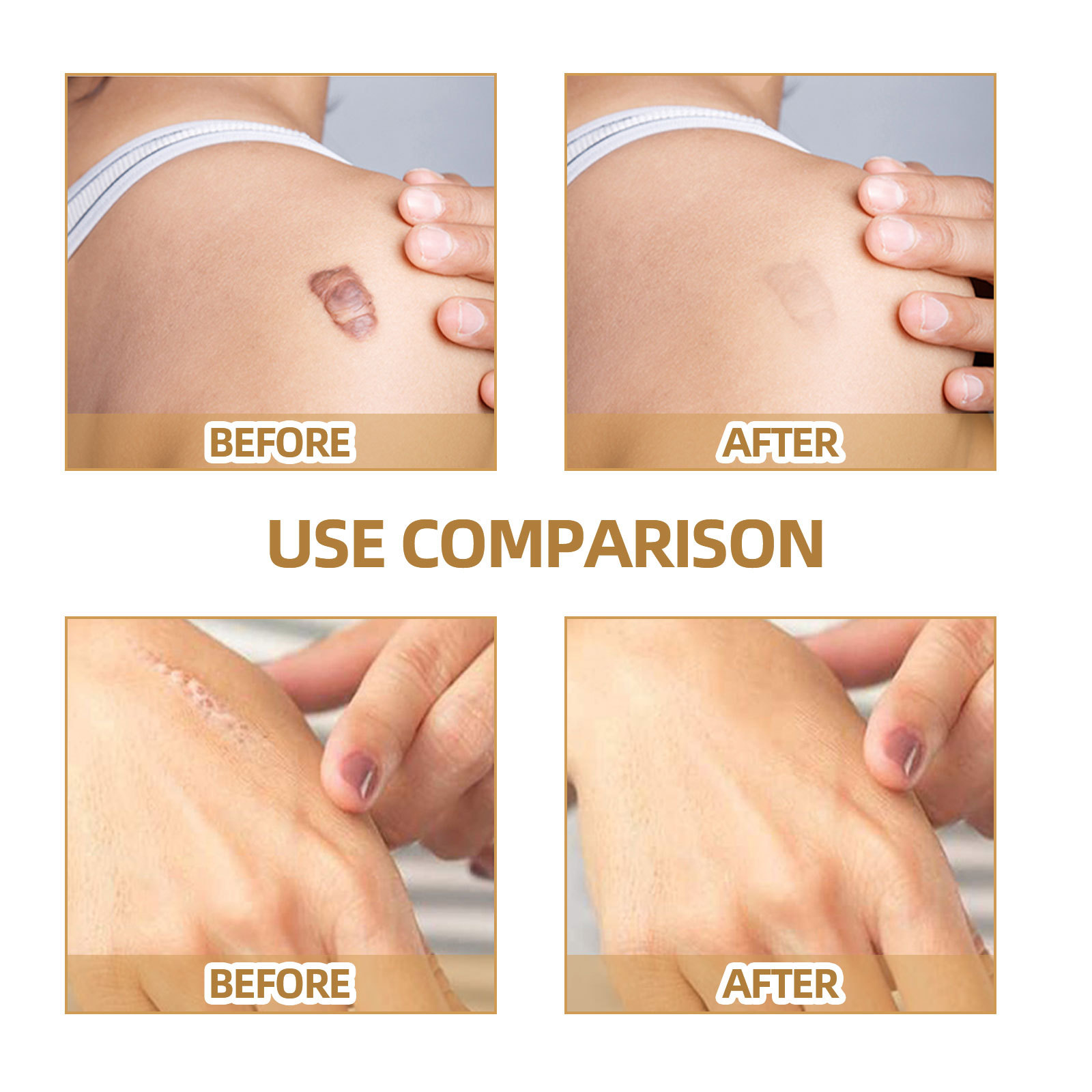 Jaysuing Tattoo Cover Up Skin Color Scar Concealer Sticker Portable Flaw Birthmark Concealing Waterproof Beauty Cosmetic Tools