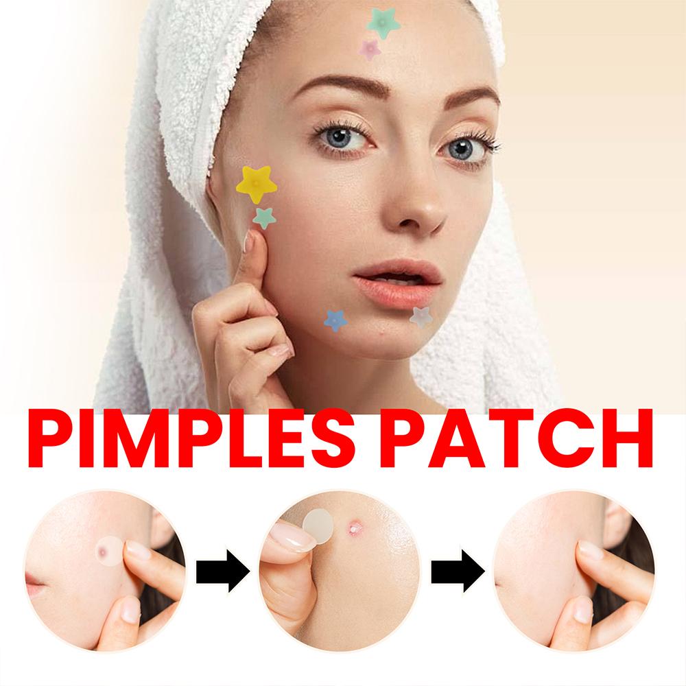 (star) Star Pimple Patch 200pcs Set Acne Invisible Acne Removal Stickers Acne Treatment Pimple Remover Concealer Face Spot Beauty Face Skin Care Makeup Tools