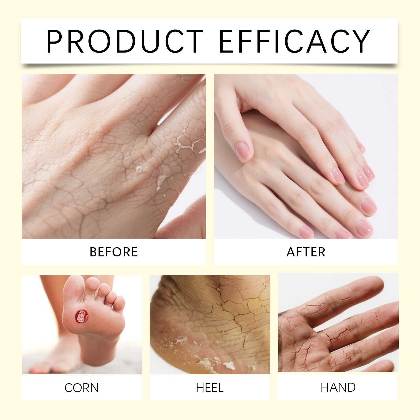 Hand Foot Moisturizing Care Cream Mild Hydrating Nourishing For Heels Elbows Whole Body Skin