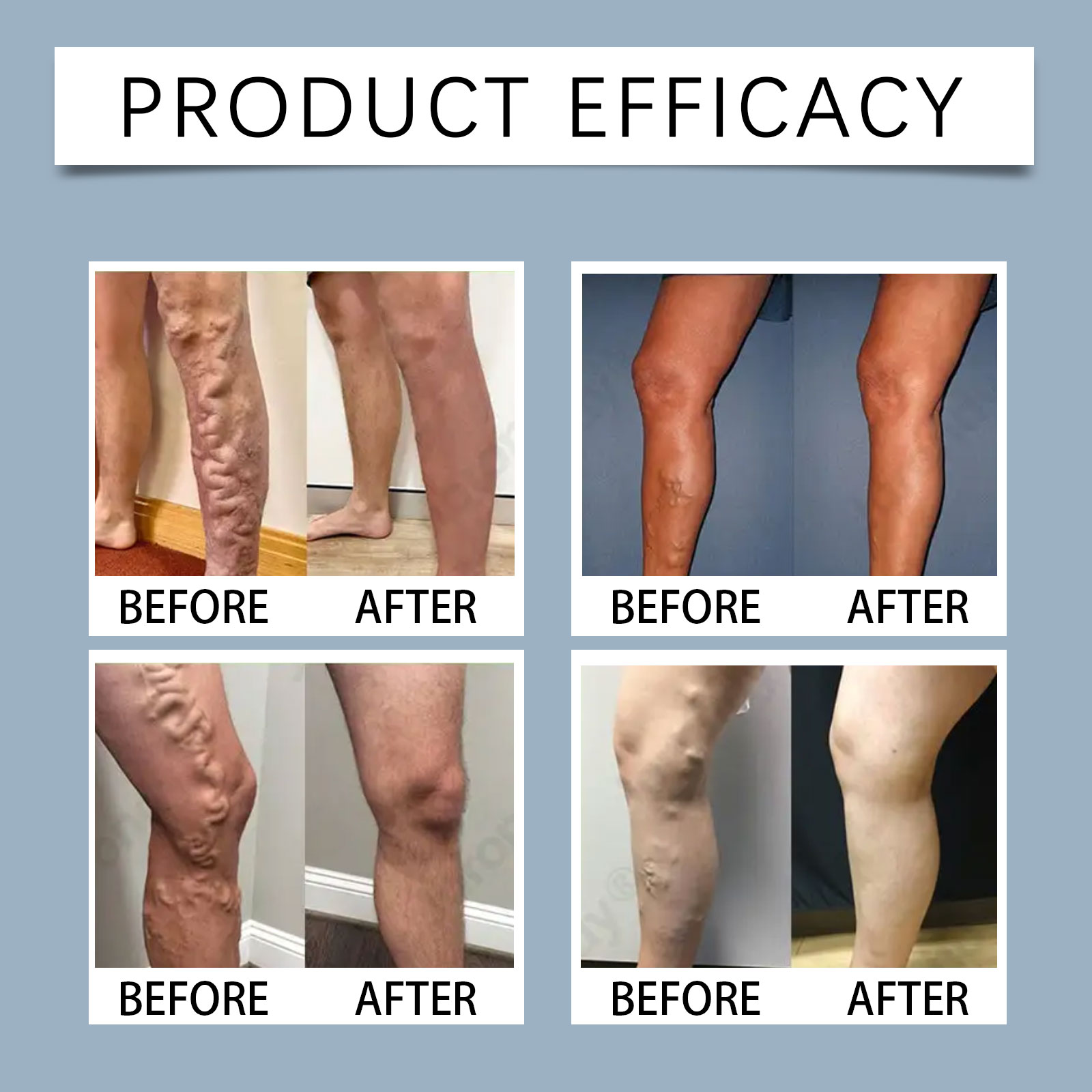 Leg Care Patch Mild Gentle Application Skin Friendly Material Leg Care Improvement Daily Movement Comfort Experience