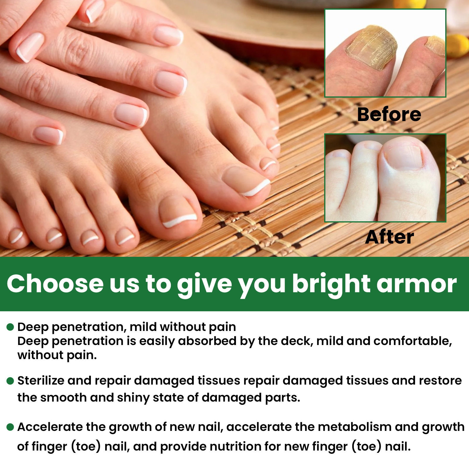 Nail Fungus Treatment Liquid Restoring Strengthening For Toenails Fingernails Daily Home Care 30ml