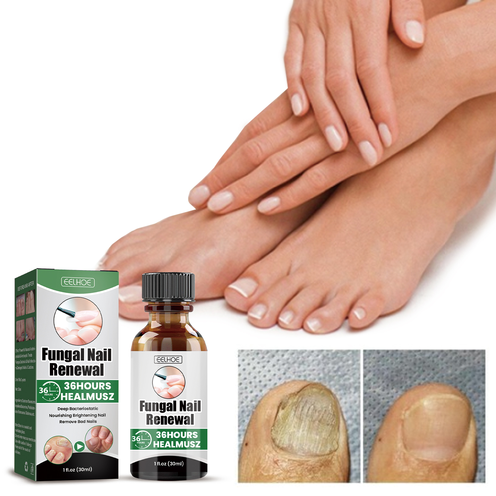 Nail Fungus Treatment Liquid Restoring Strengthening For Toenails Fingernails Daily Home Care 30ml
