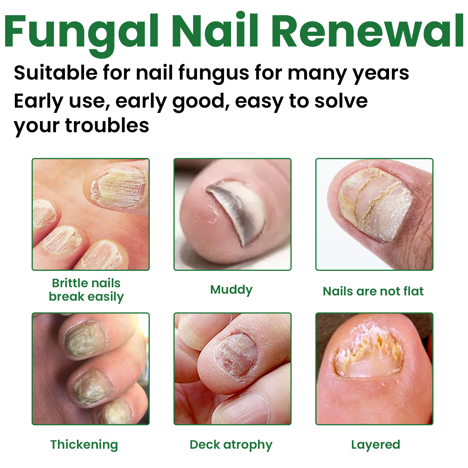 Nail Fungus Treatment Liquid Restoring Strengthening For Toenails Fingernails Daily Home Care 30ml
