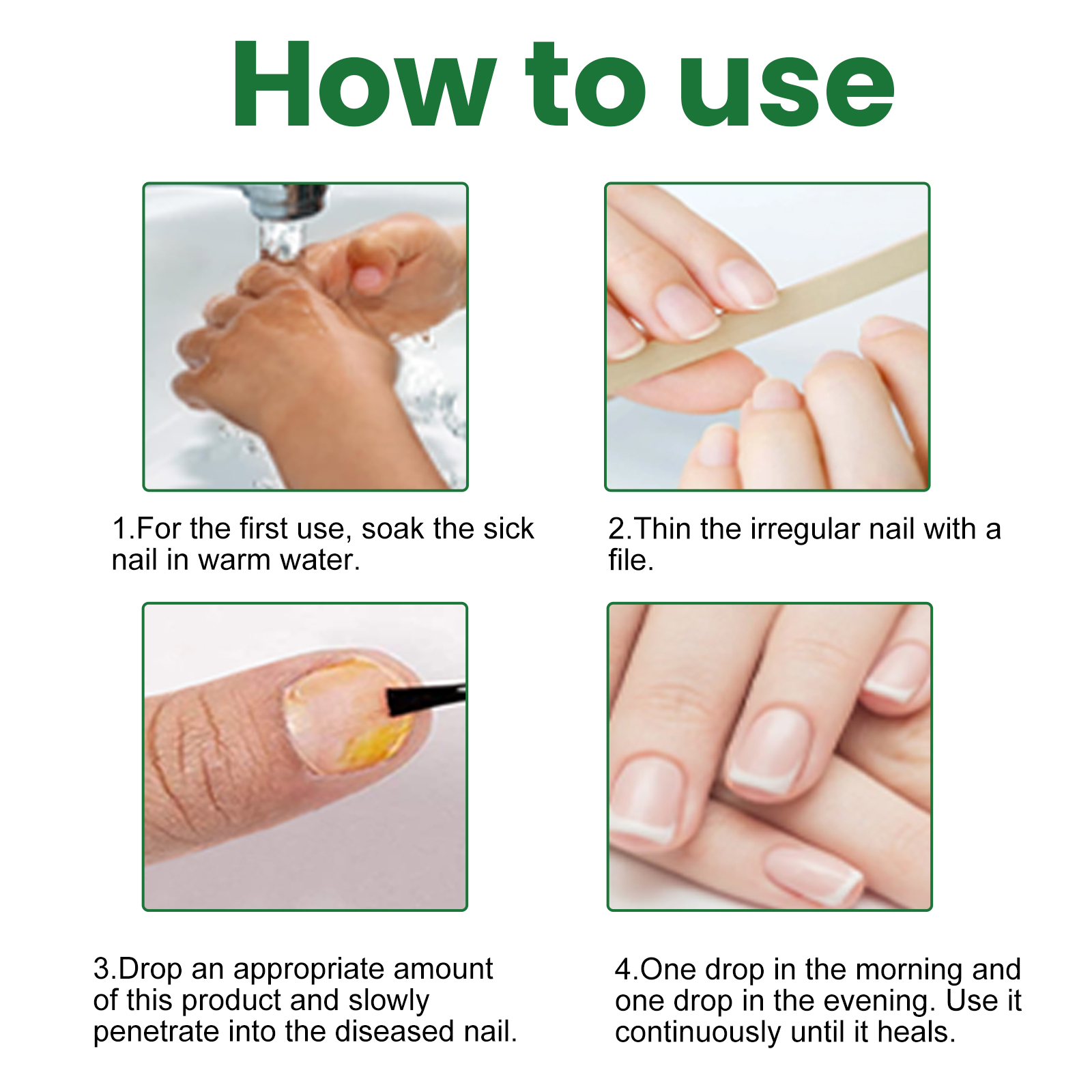 Nail Fungus Treatment Liquid Restoring Strengthening For Toenails Fingernails Daily Home Care 30ml