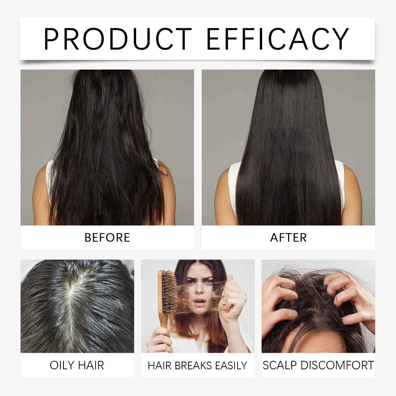 Hair Nourishing Moisturizing Spray Biotin Caffeine For Scalp Care And Daily Hair Treatment 100ml