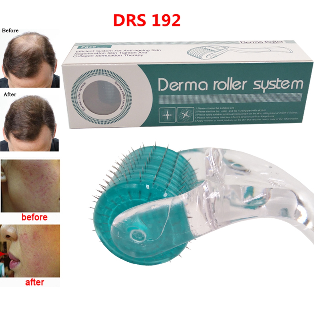(0.2mm) Derma Roller DRS 192 Face Massage Roller Titanium Microneedling Roller for Stimulate Beard