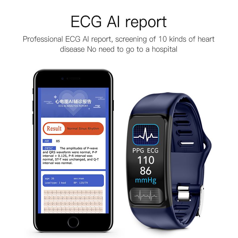 Monitoring Smart Wristband ECG PPG Smart Watch Heart Rate Blood Pressure Bracelet Smart Bracelet