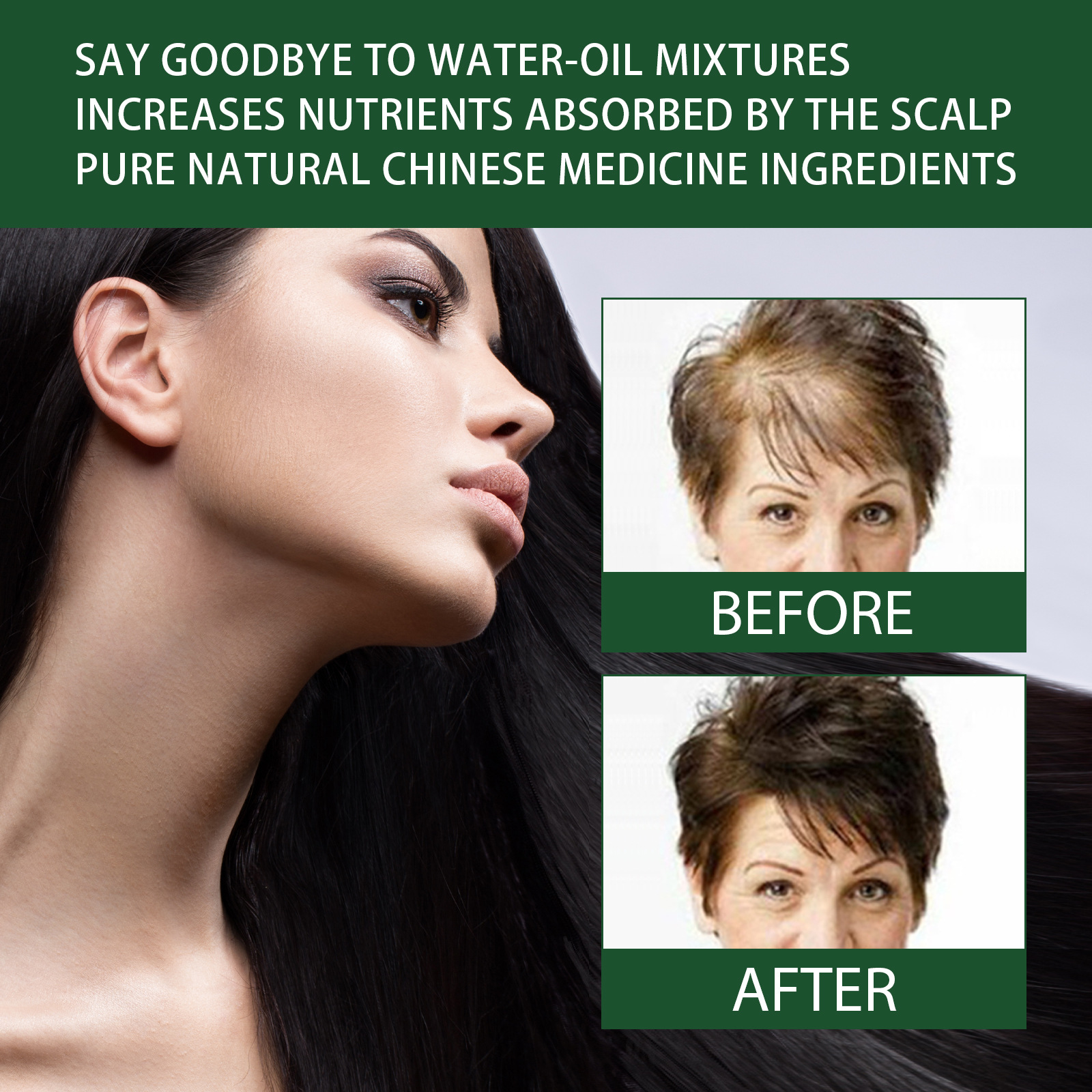 Ginger Hair Growth Essence Hair Care Oil 7 Day Ginger King Serum Nourishing Hair Nutrition Dense Hair Nutrient Solution 30ml