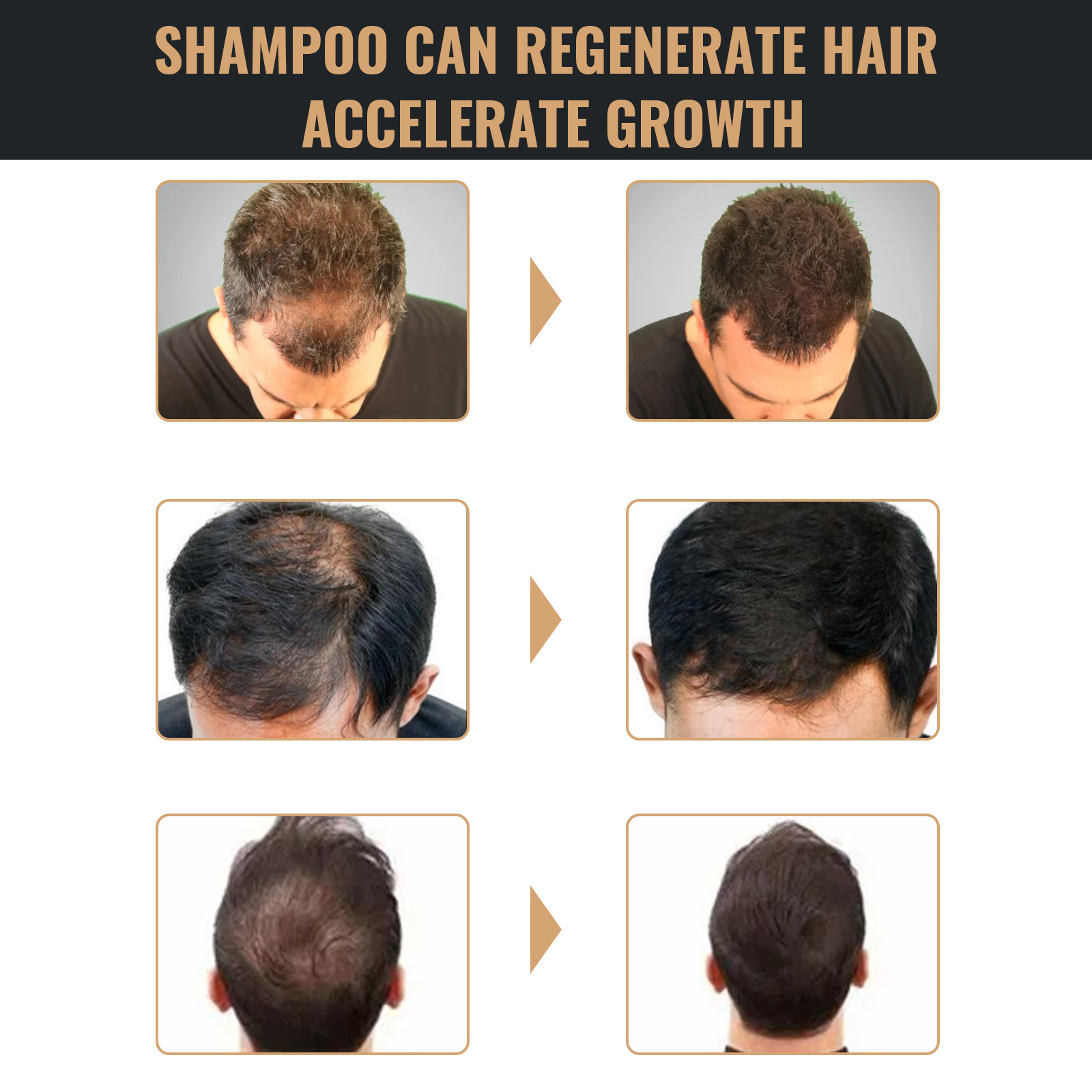 Root Activating Shampoo Control Volume Essence Oil Anti Baldness Colorng Cream Cover Dye Shampoo Fast Thicker Dense Deep Cleansing Follicles 100ml