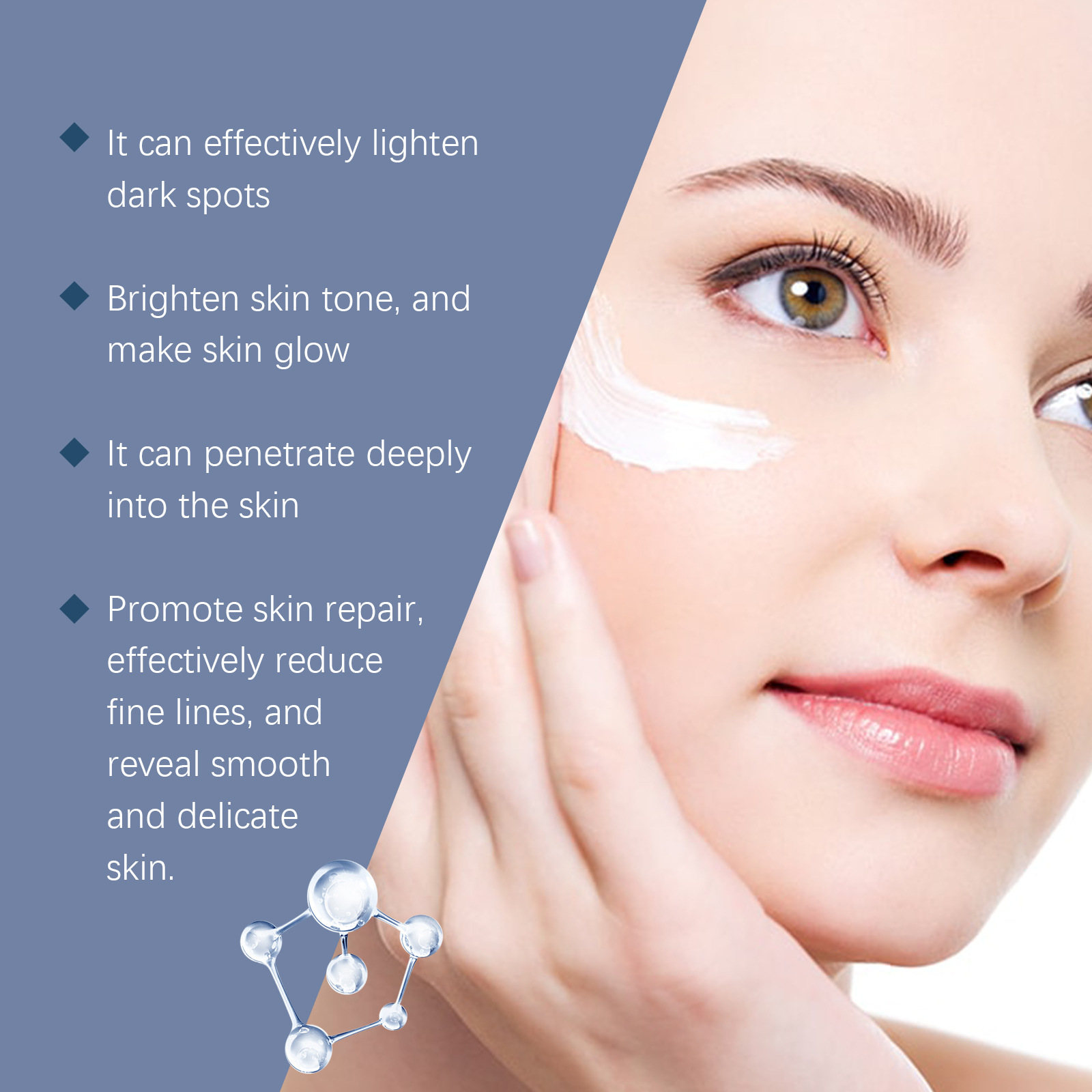OUHOE Freckle Remover Cream Face Removing Dark Spot Melasma Chloasma Senile Plaques Sunburn Cyasma Chorioplaque Freckle